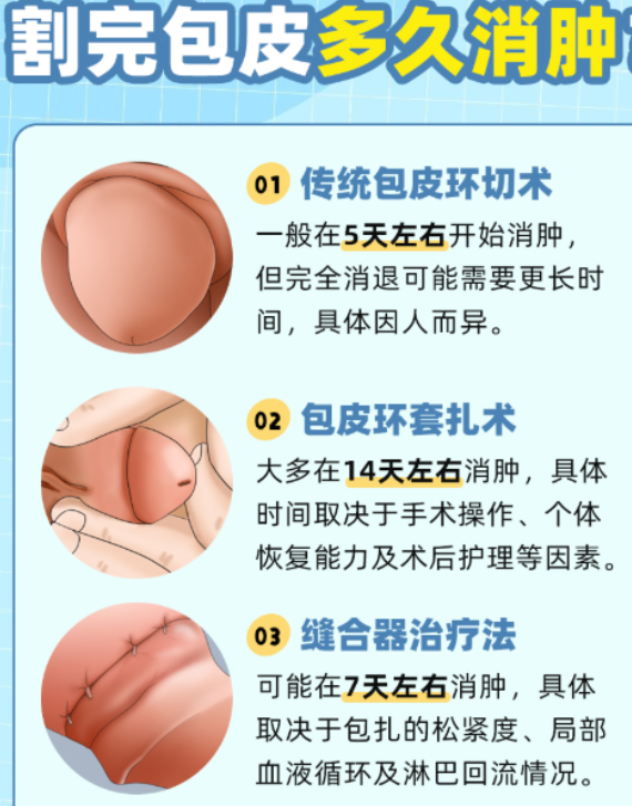 包皮环切手术是治疗包茎和包皮过长的常规手术