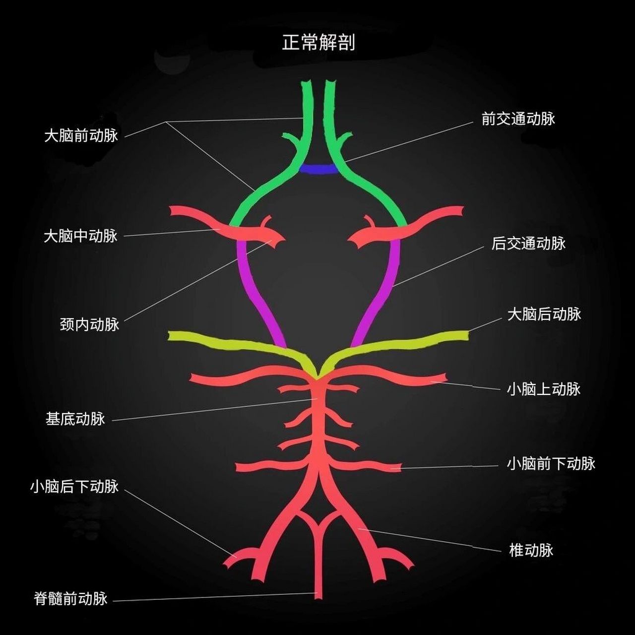 大脑中动脉皮质支图片