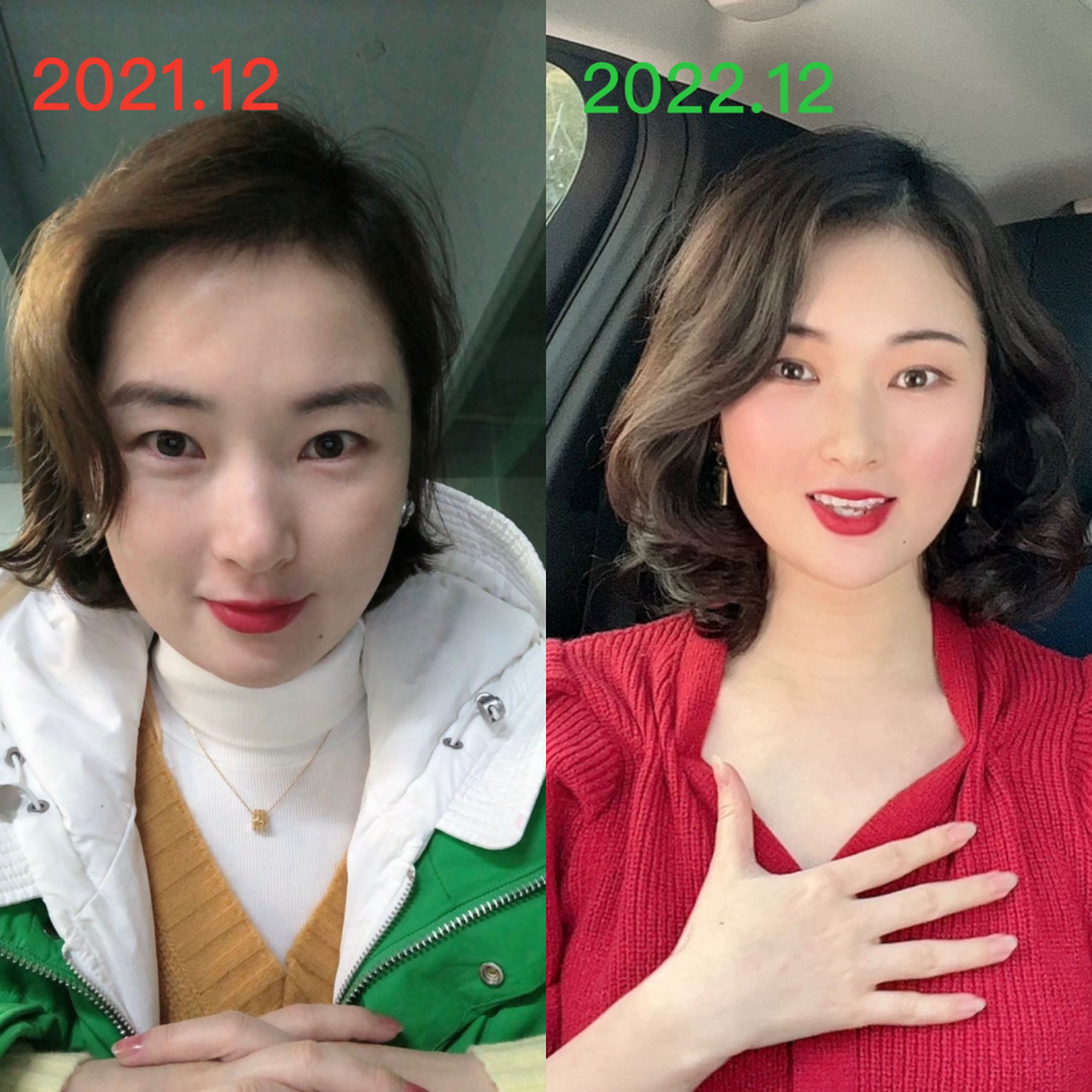 养发一年前后对比,人都自信了04 我是那种天生头发就很少,然后还狂