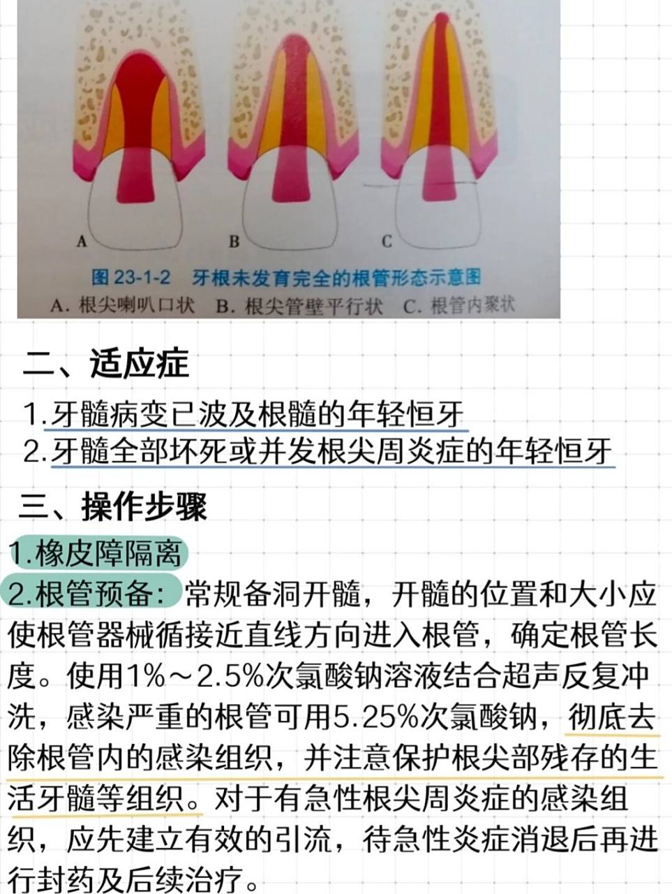根尖诱导成形术