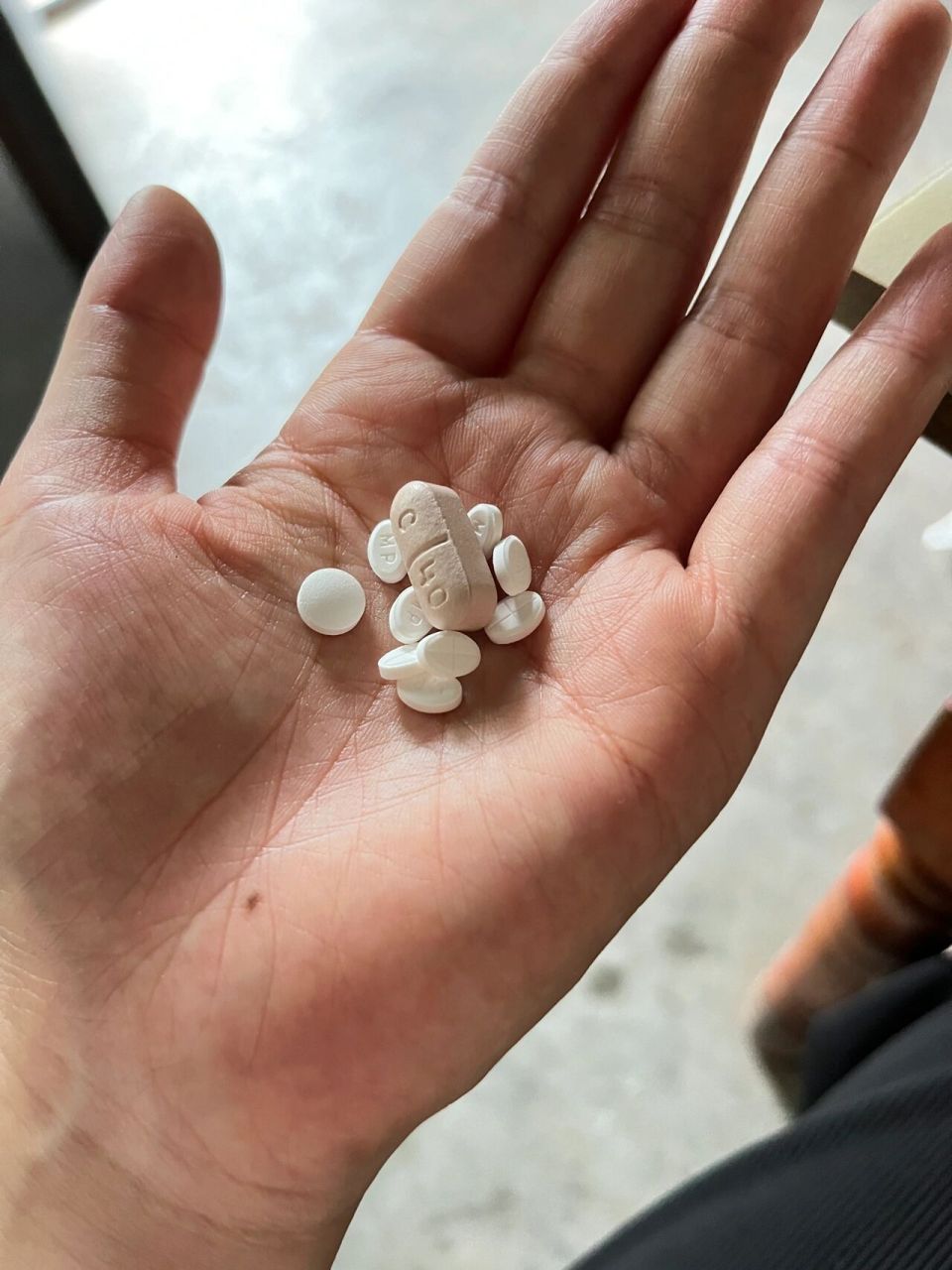令人生厌的满月脸～激素第二月零7天 会恢复吗?激素停了会恢复吗?