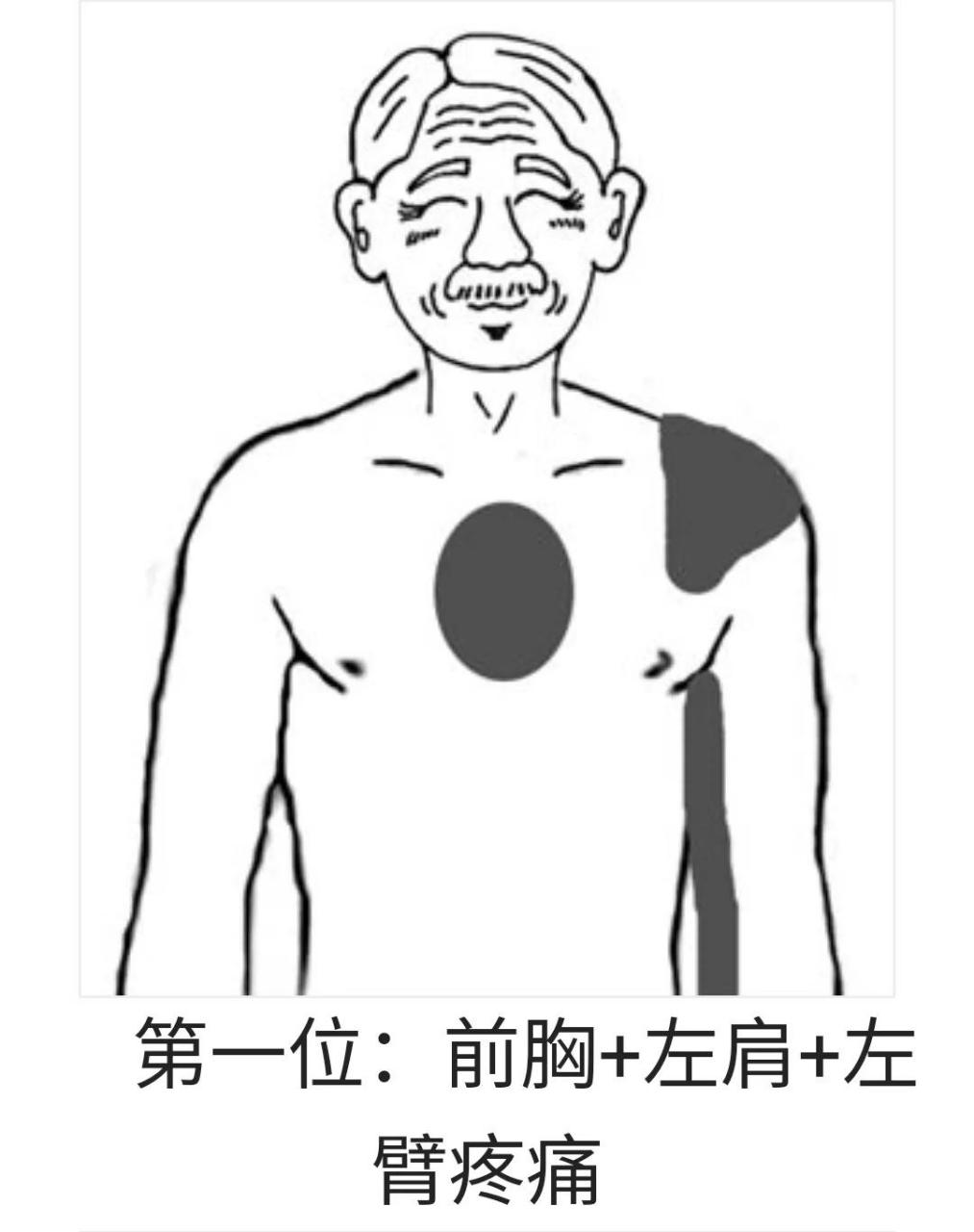 心梗及心绞痛的疼痛部位