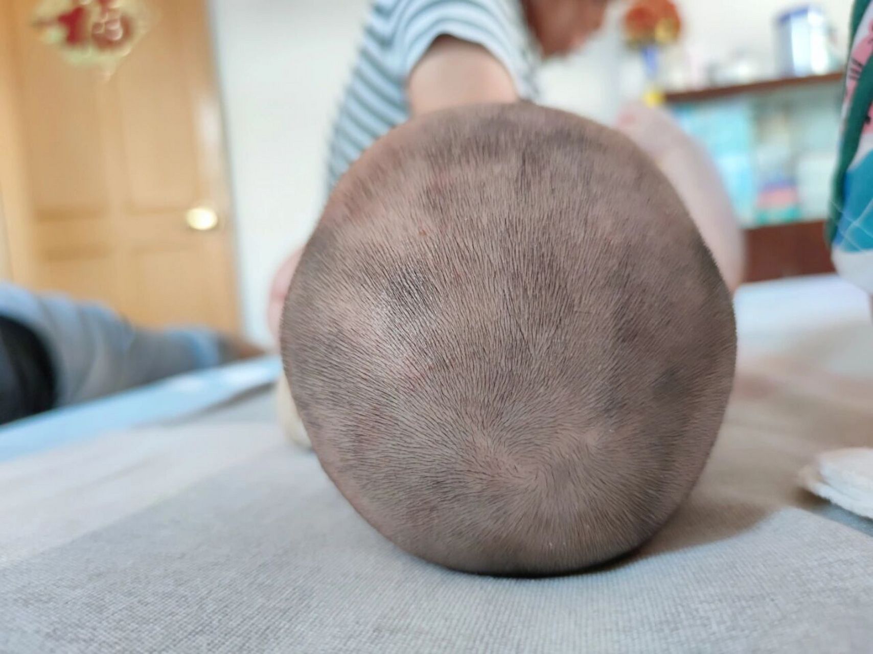 宝宝这算什么头型呢,家里老人们说她头型挺圆的,说头顶高长大个[笑哭]