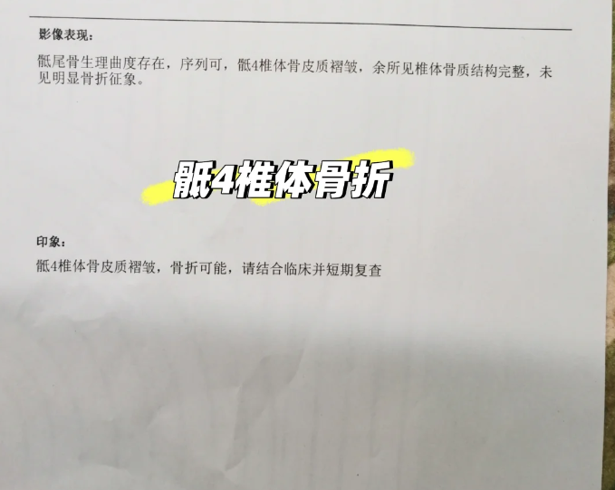 骶4骨骨折是否需要卧床要看具体情况