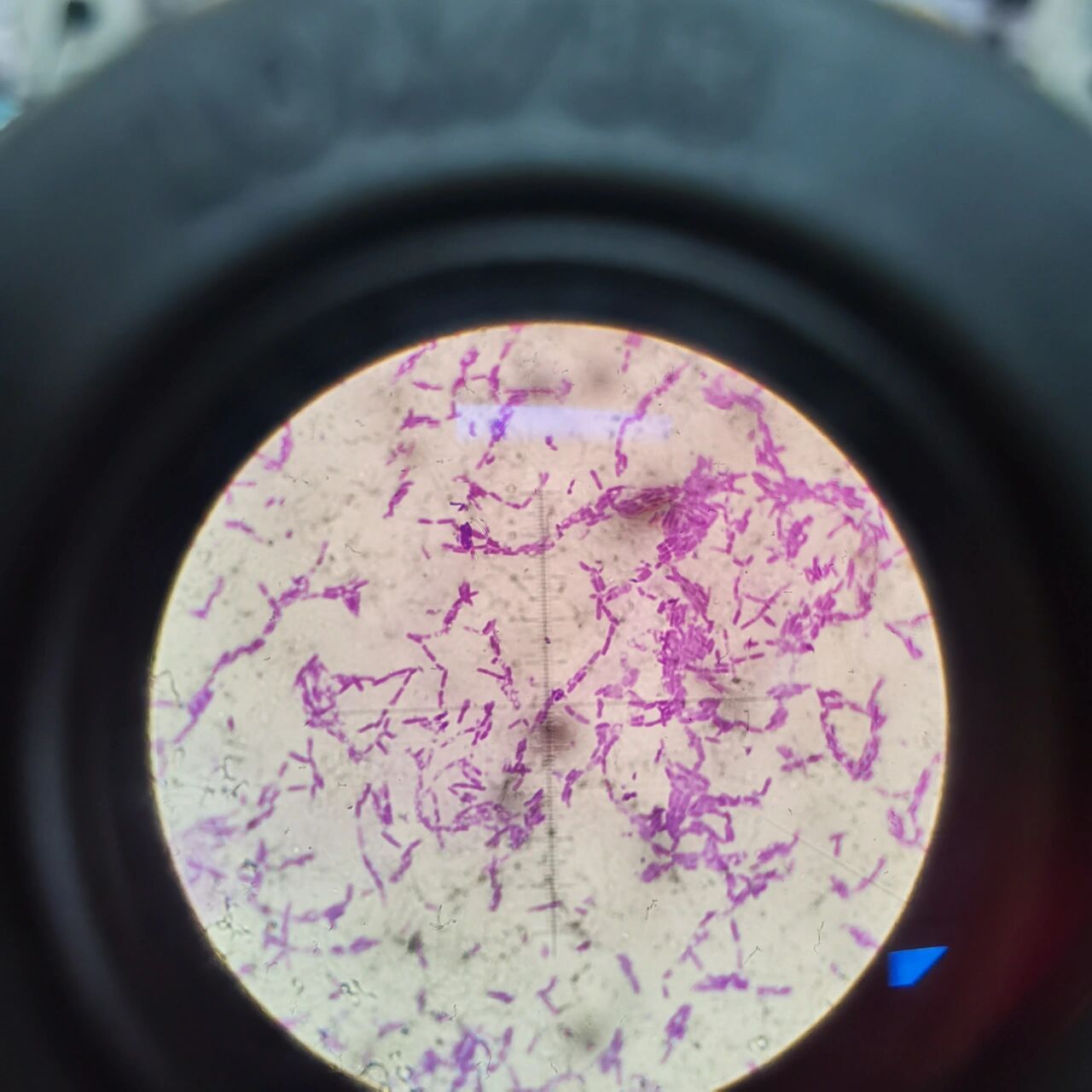 放线菌100倍显微镜图片图片