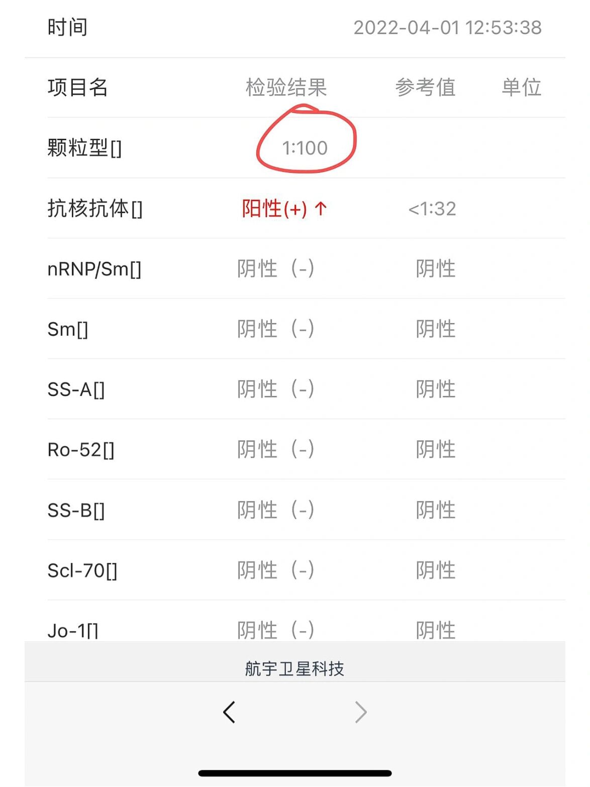抗核抗体阳性,颗粒型 单抗核抗体颗粒1:100,之前4月检查之后咨询医生