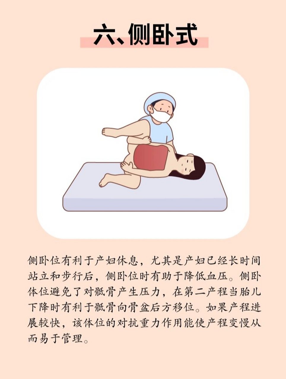 什么是自由体位分娩?