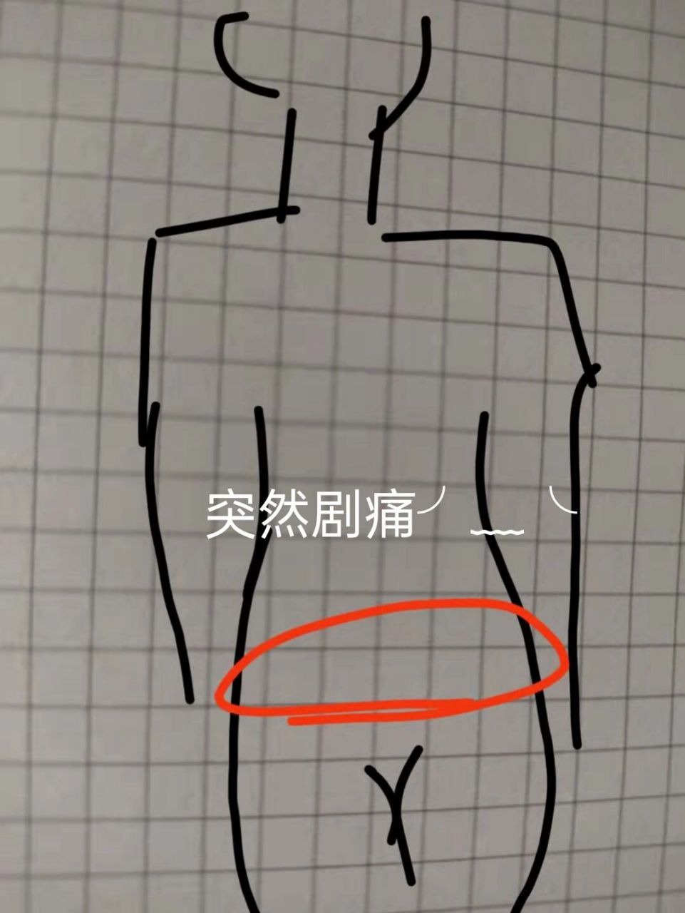 右屁股上面腰下面疼痛图片