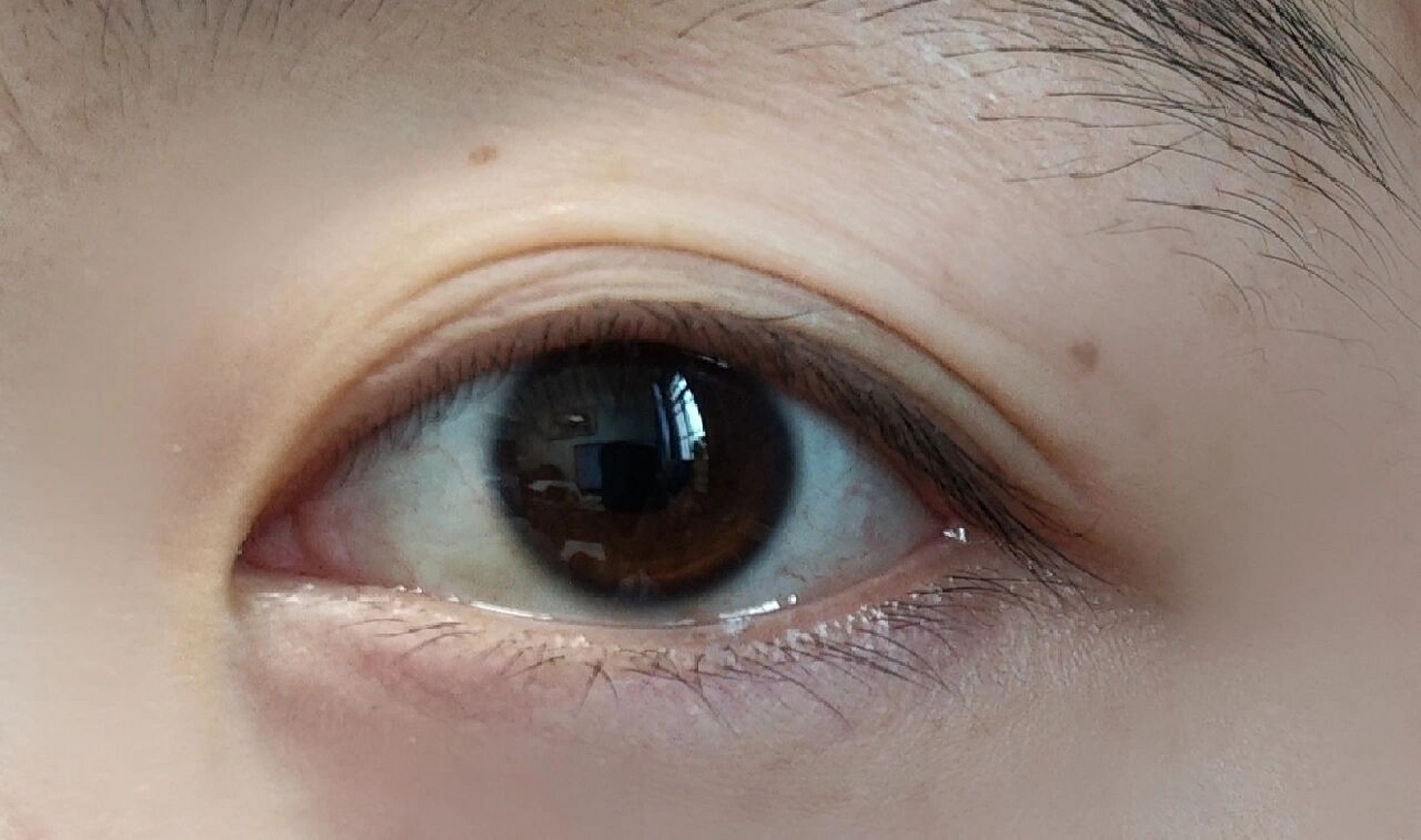 亚洲人的瞳孔颜色图片