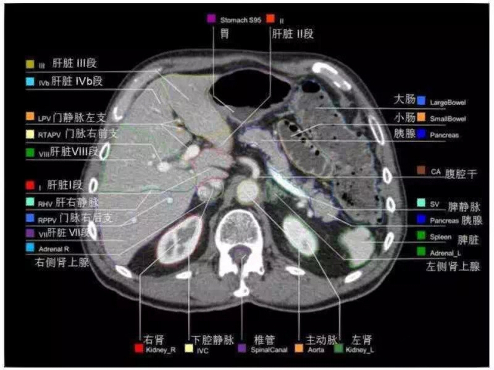 腹部ct高清实用图谱3️⃣ 1.2都在上面,自己去翻啦宝贝们