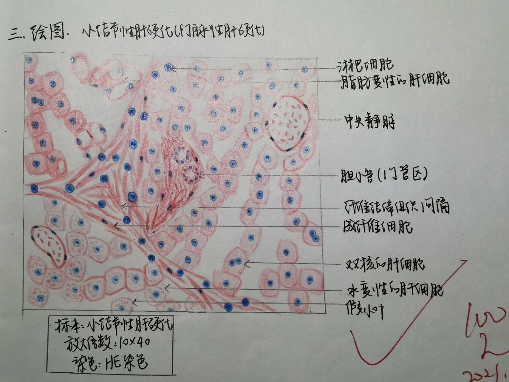 病理实验红蓝铅笔绘图4-小结节性肝硬化 好像是最后一次要画图的啦