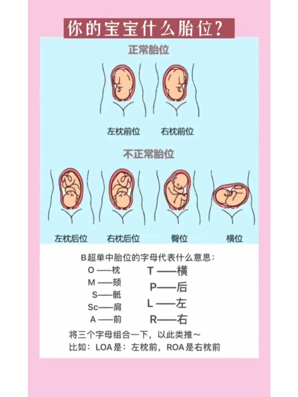 在接了一个月的胎位 终于从左抵横变为左枕前啦