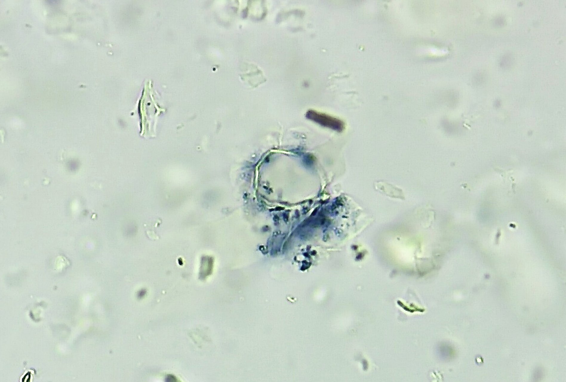 翻一翻以前的做的粉末显微鉴定-大青叶 大青叶来源于十字花科植物菘蓝