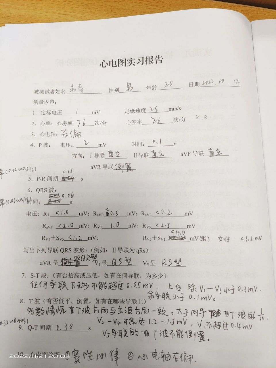 心电图实习报告来喽