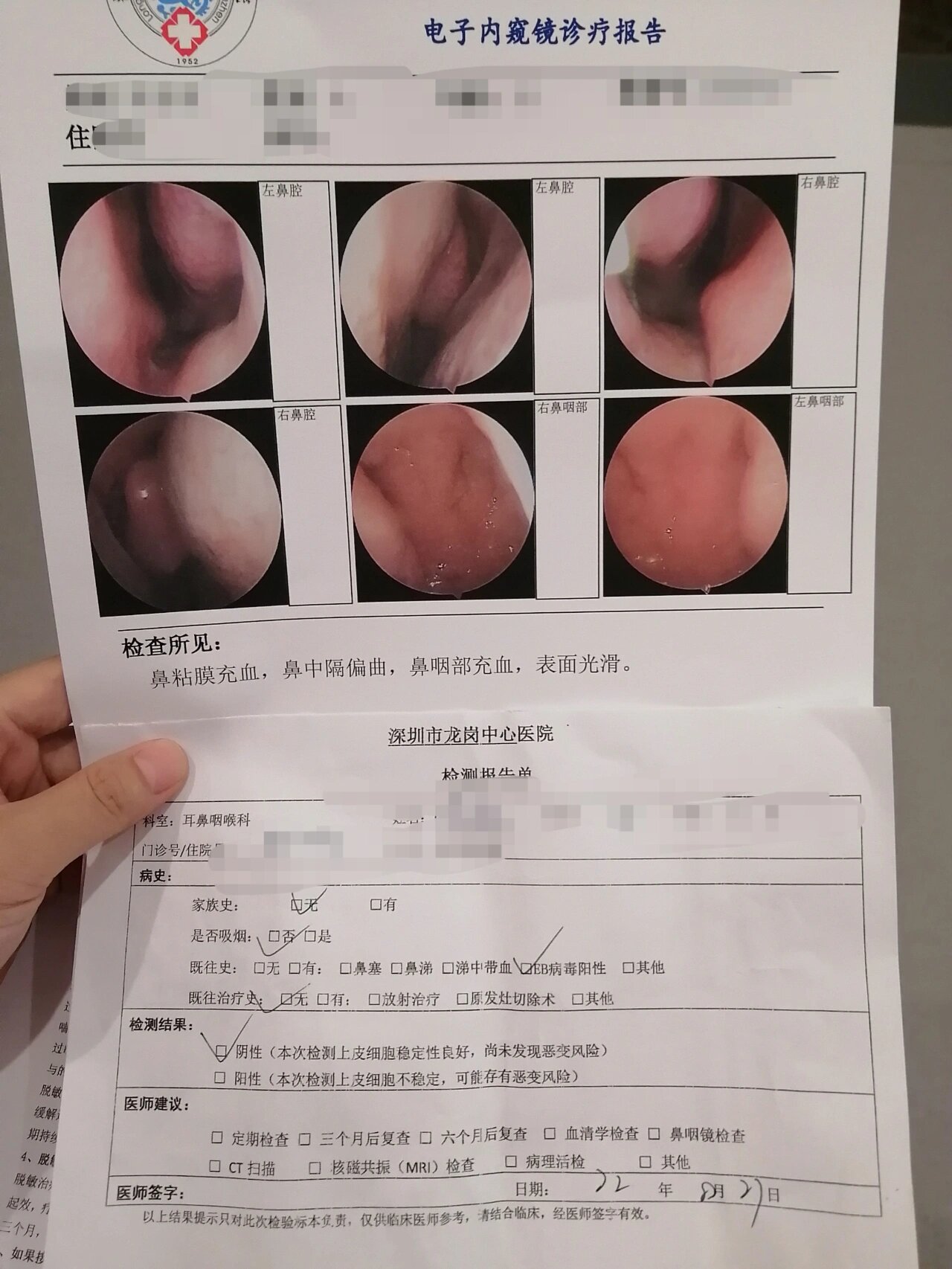 eb病毒三个月复查还是抗体阳性为什么在线