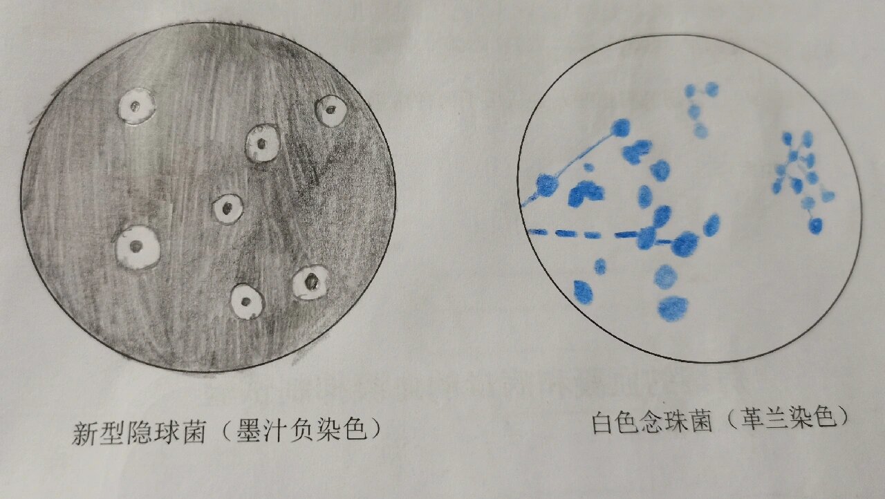 病原实验报告第五弹