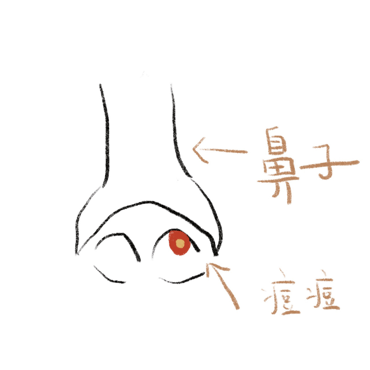 疼的睡不着觉 太难受了01 突然鼻子里面就长了痘痘