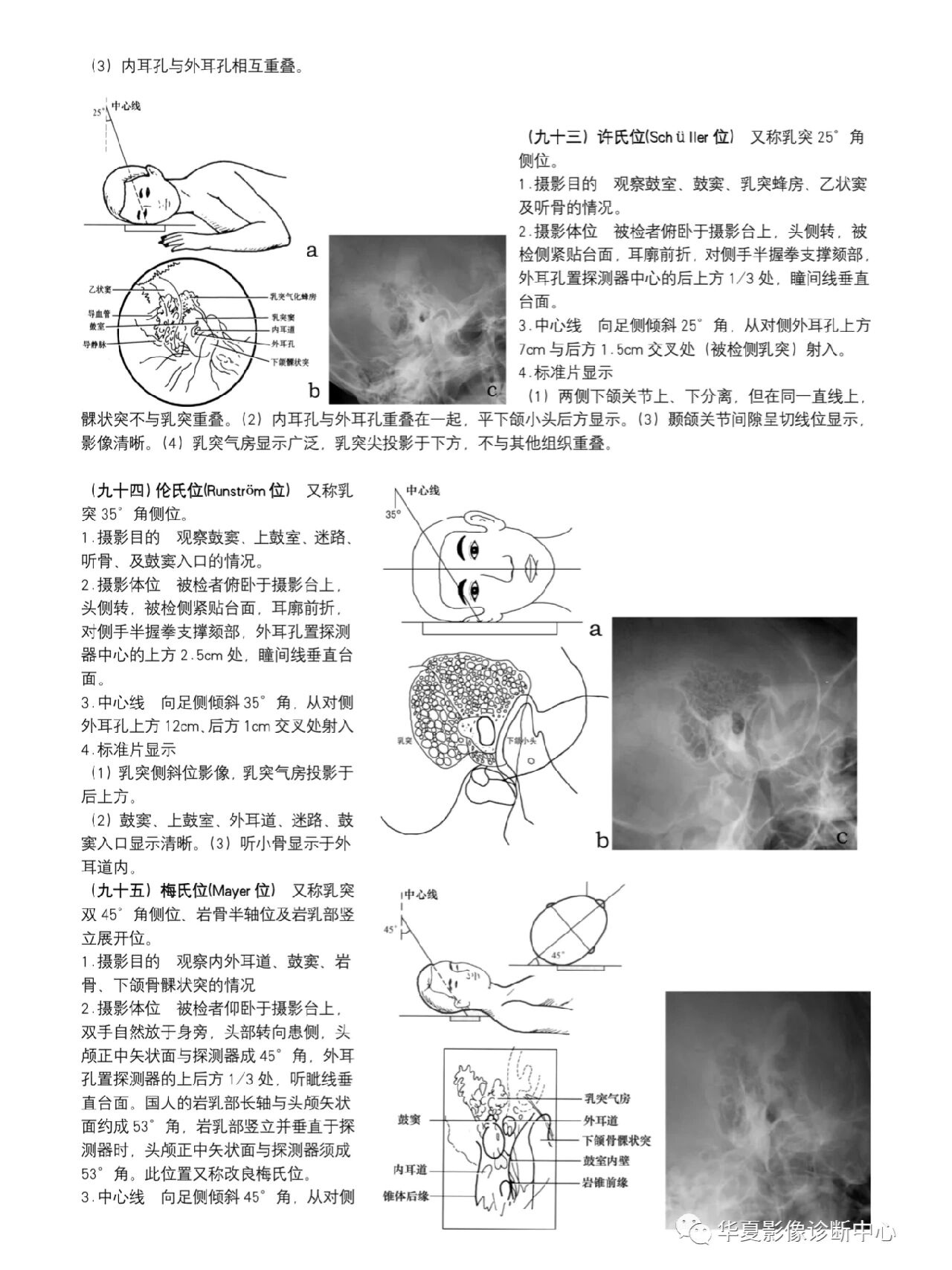 顶颌位的图解图片