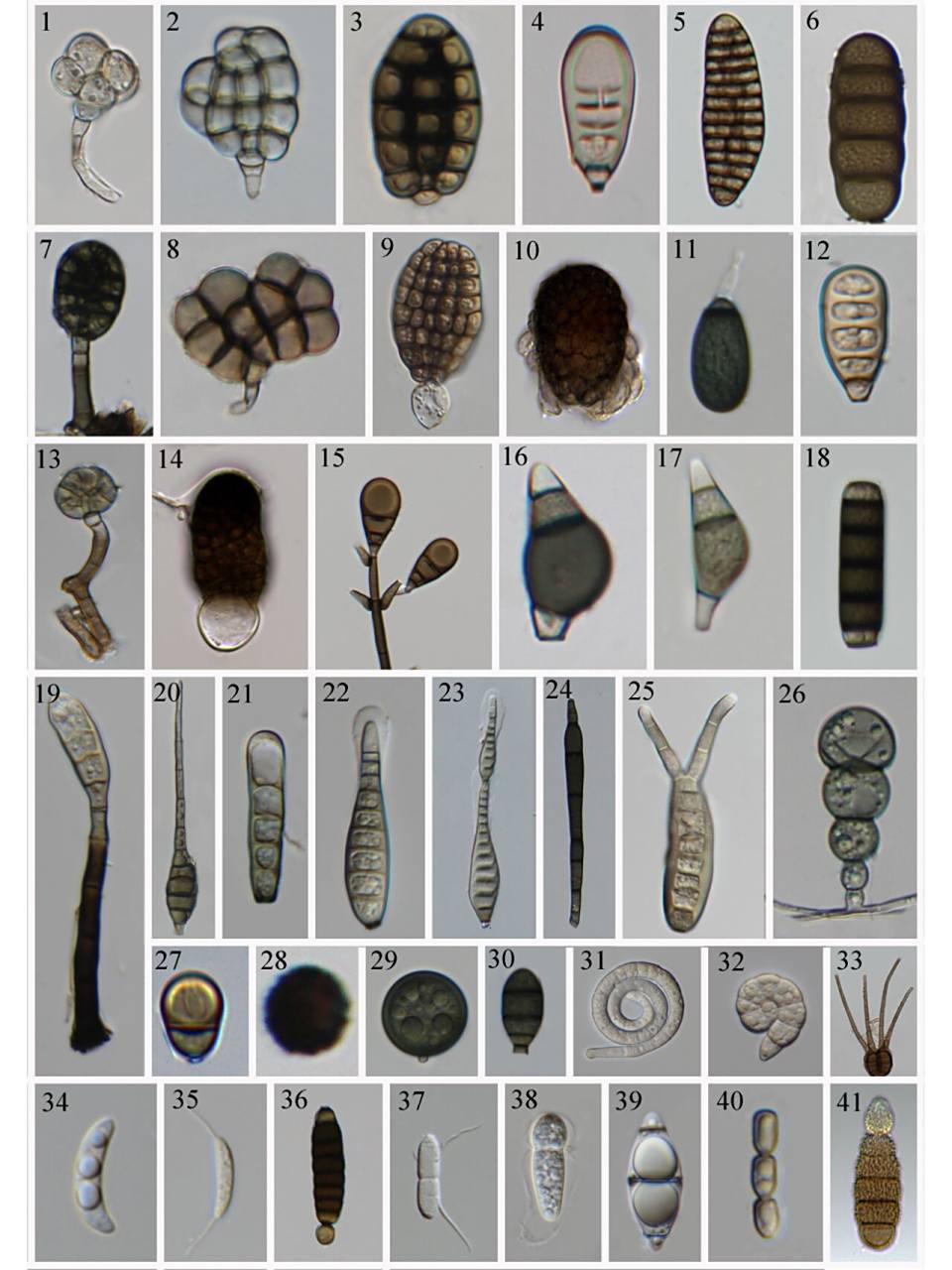 一张图告诉你真菌孢子的多样性 1-2:不认识,大概率是个新种 3:canali