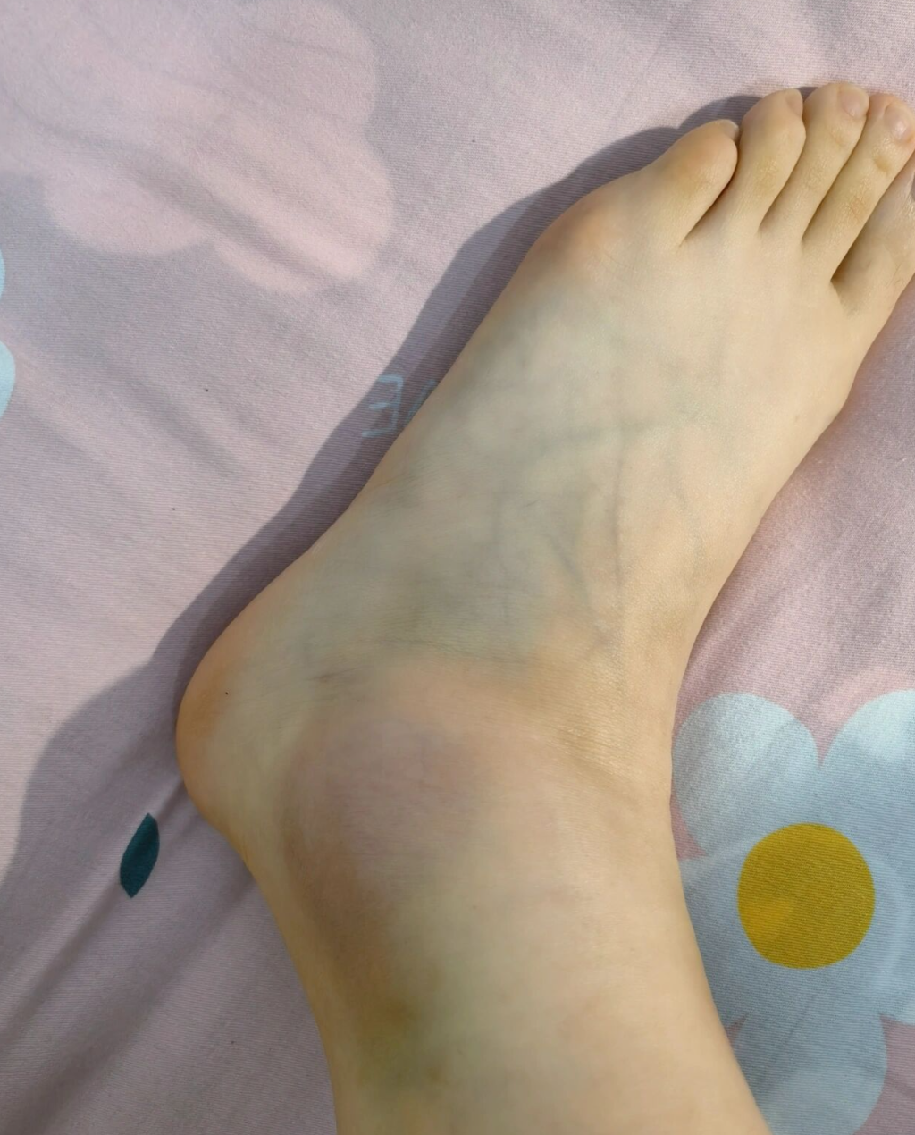 脚脖子有麻麻胀胀的感觉室什么原因?