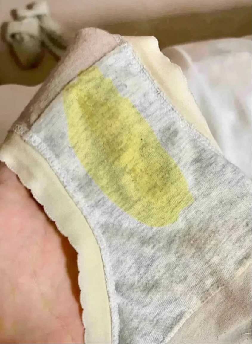 月经过后十几天出现白带还有少量血是为什么?