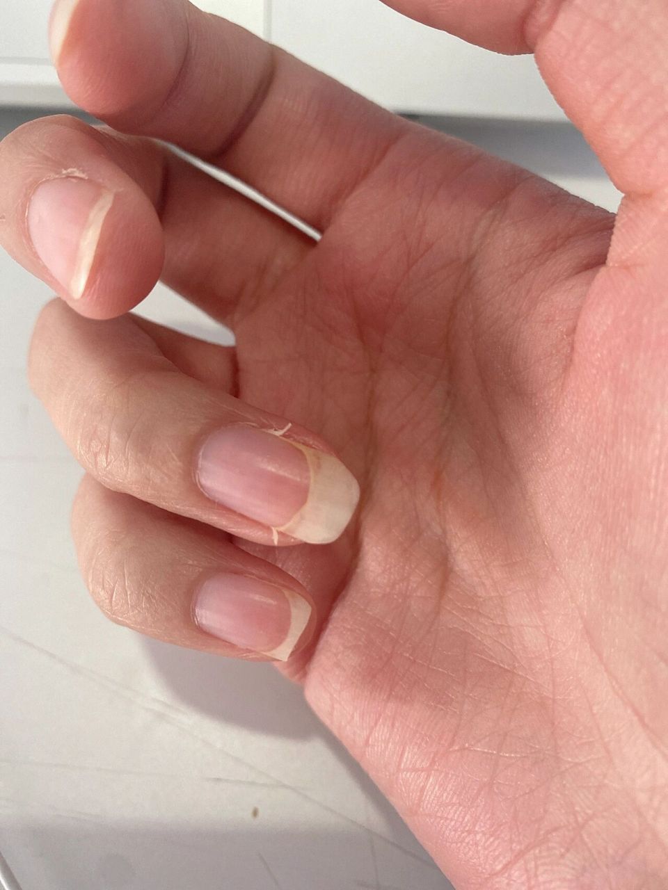这种指甲是最烦的 人家手上长倒刺,我是指甲会分叉, 撕都撕不掉,剪也