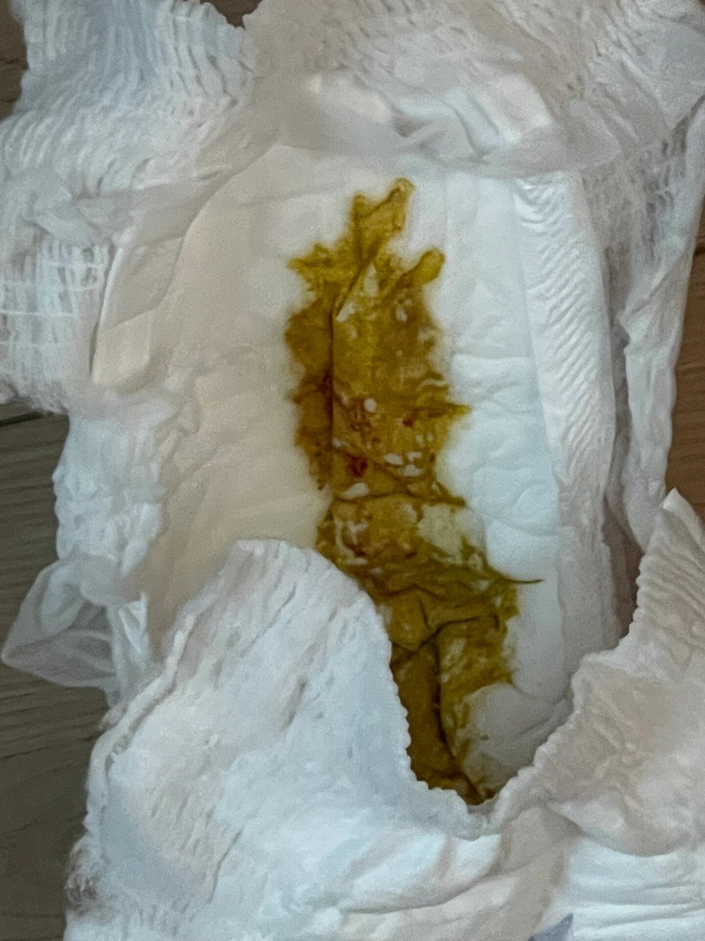 九个月宝宝大便有血(内有便便93) 宝宝从喝爱他美新包装后,开始一天