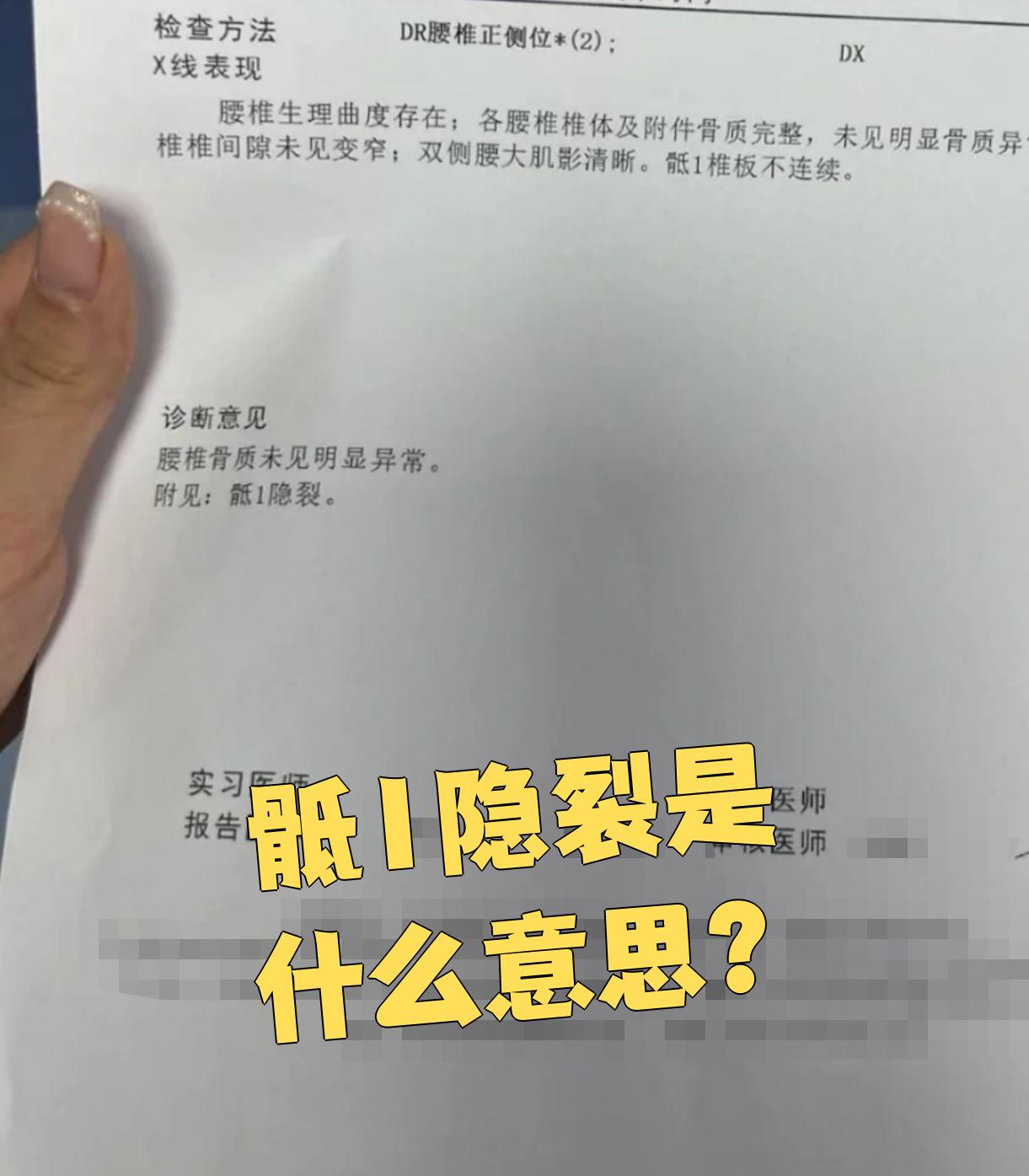骶1隐裂是指第1骶椎的隐性脊柱裂