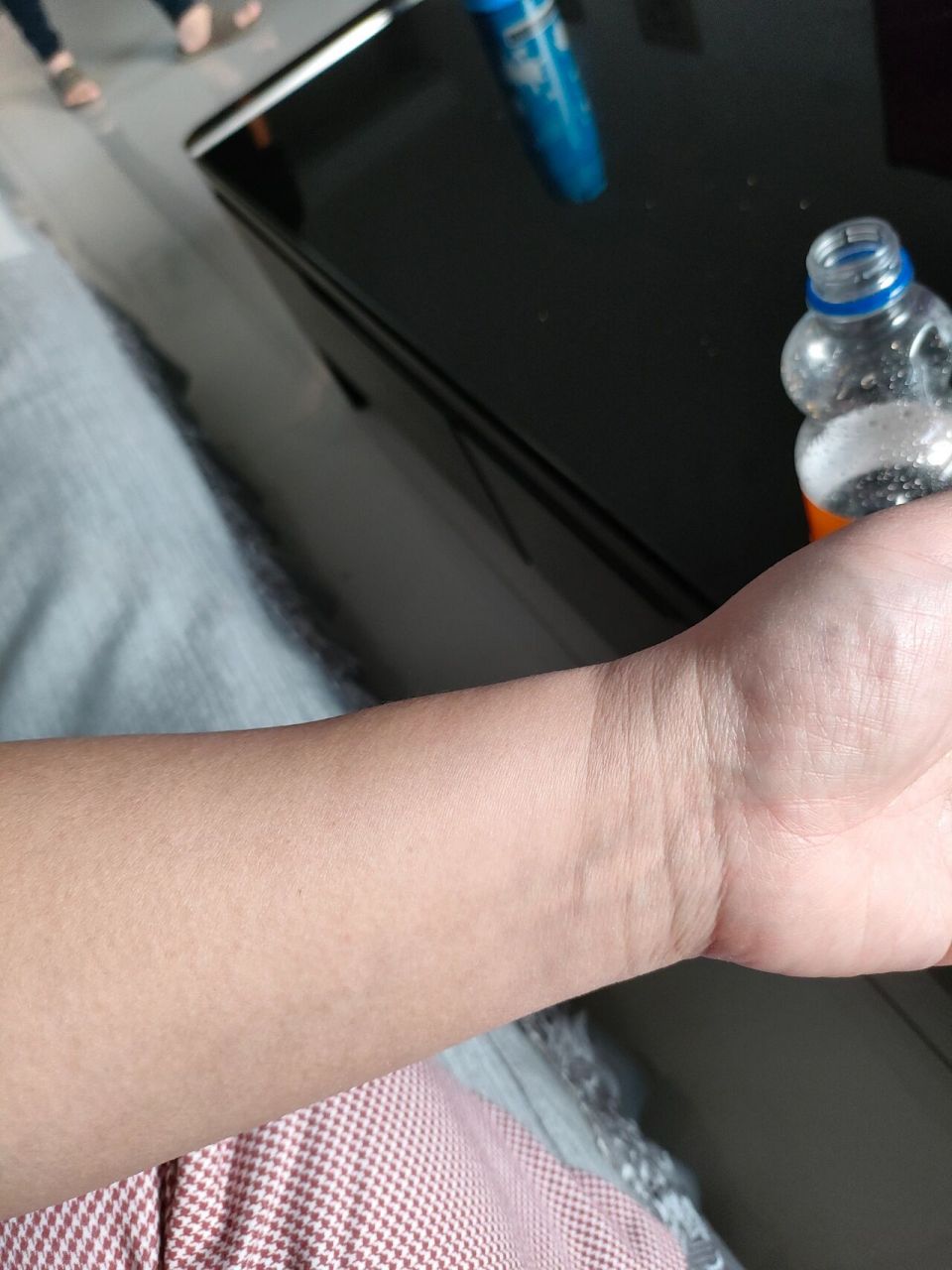 手腕上方这肿起来的,不疼,是血管吗? 不疼按压也不疼,是血管还是啥?