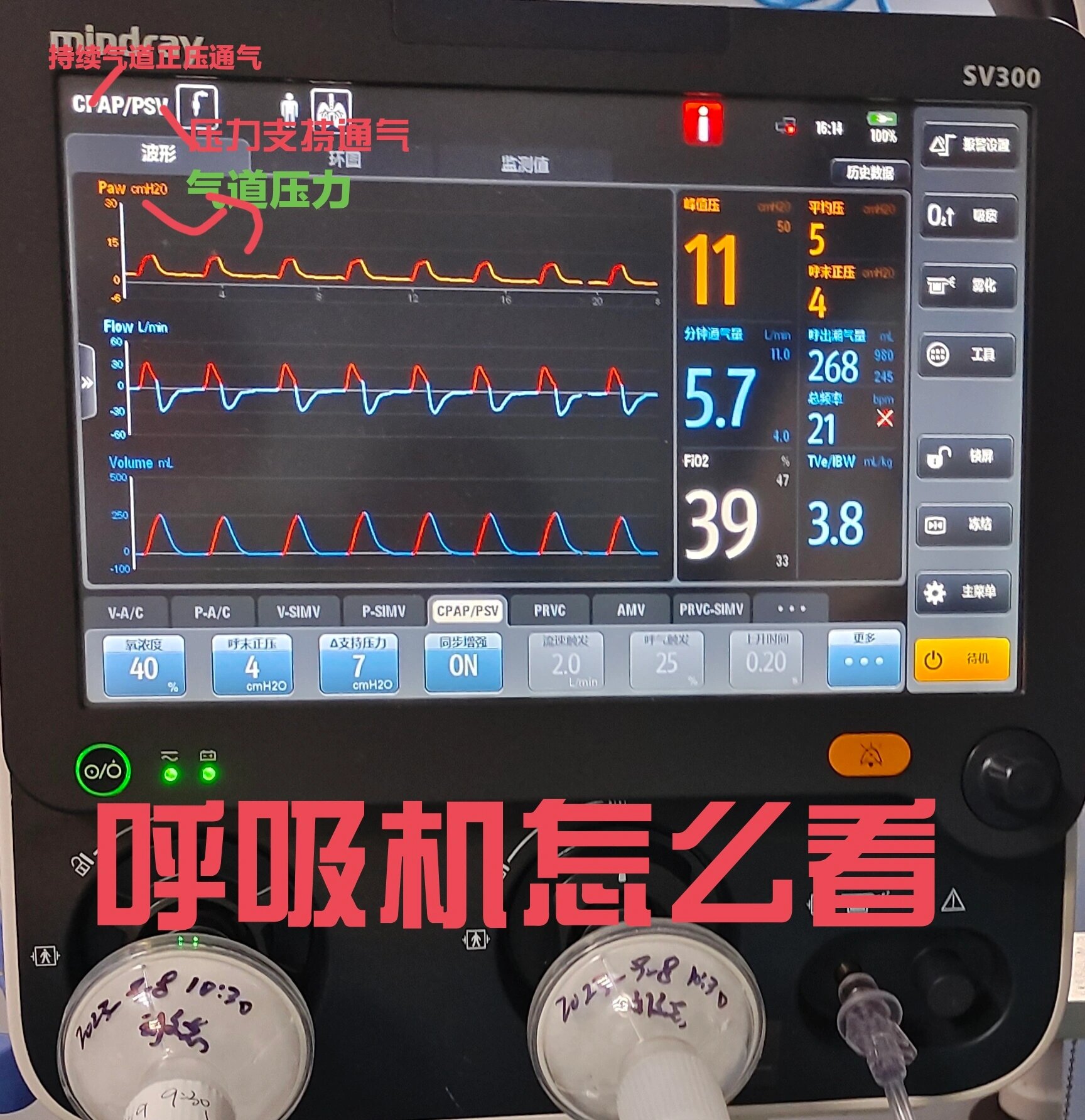 呼吸机怎么看