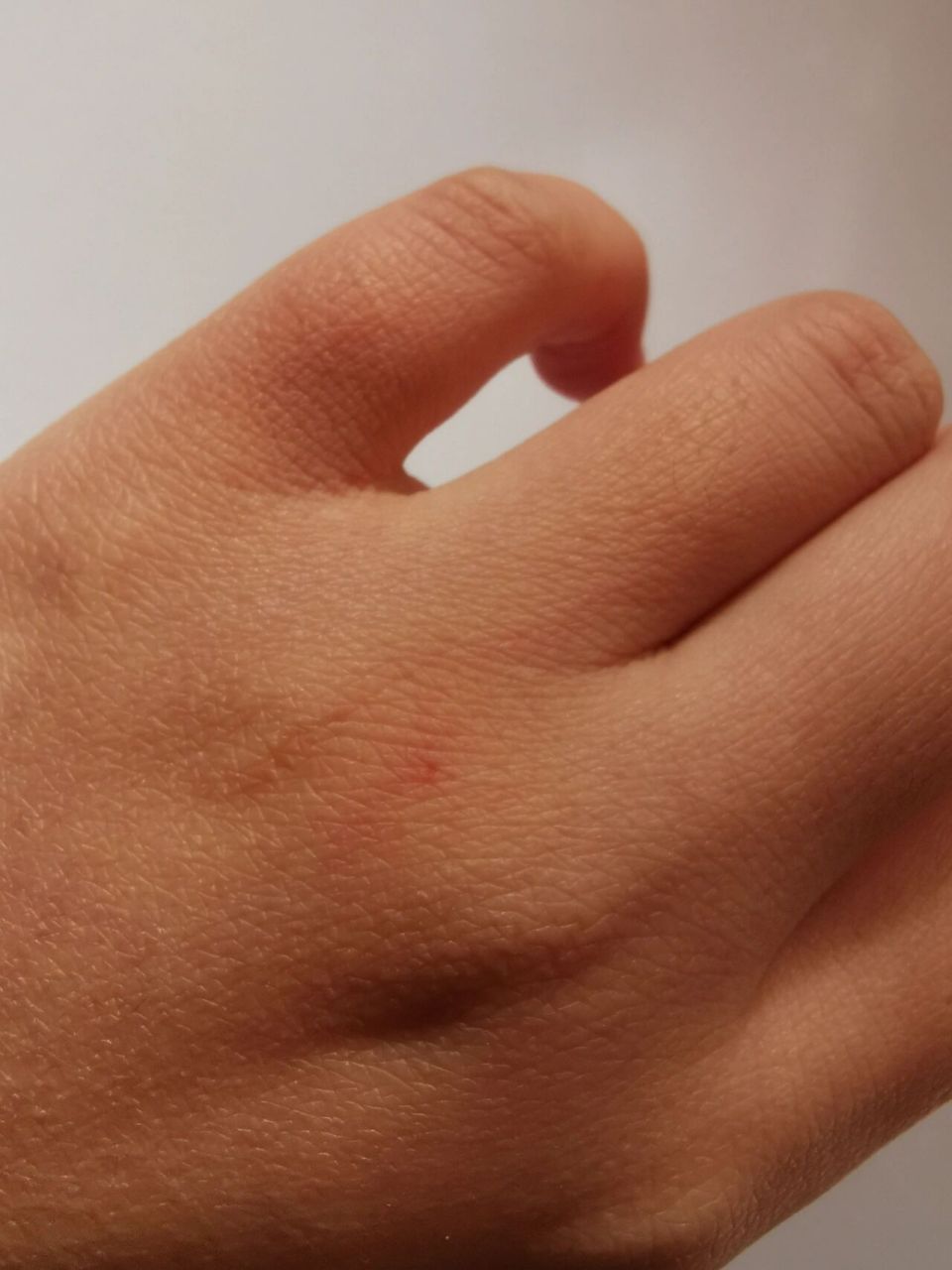 一个多月大的狗狗抓伤是不是要死了?