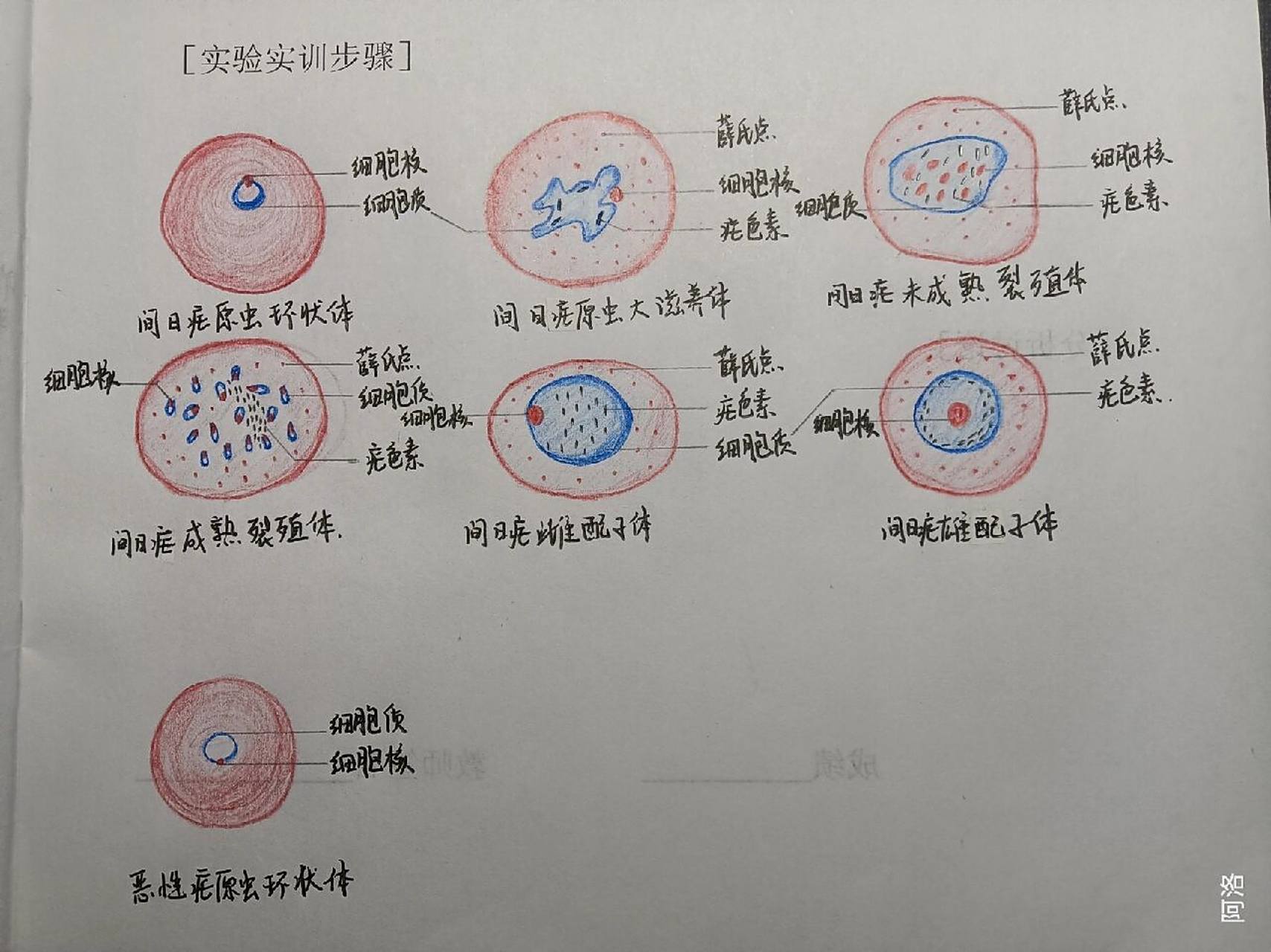寄生虫画图⑥    (间日疟原虫环状体,间日疟大滋养体,间日疟未成熟裂