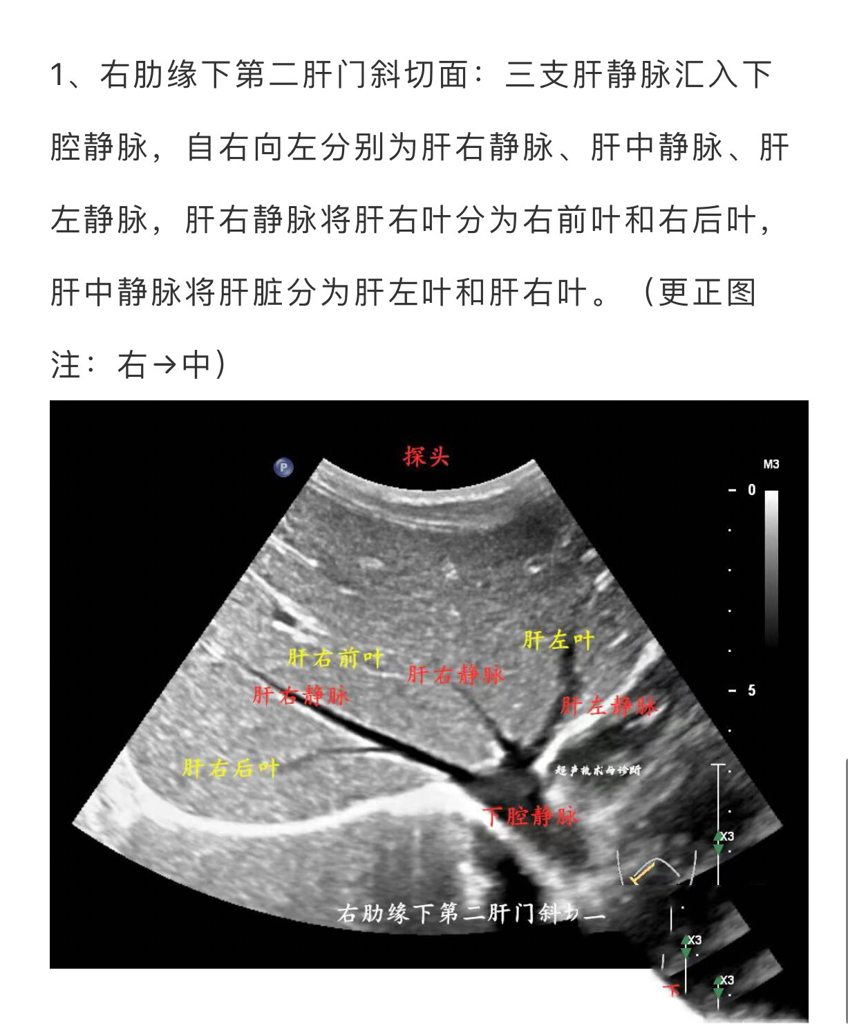 肝脏第一肝门超声图像图片