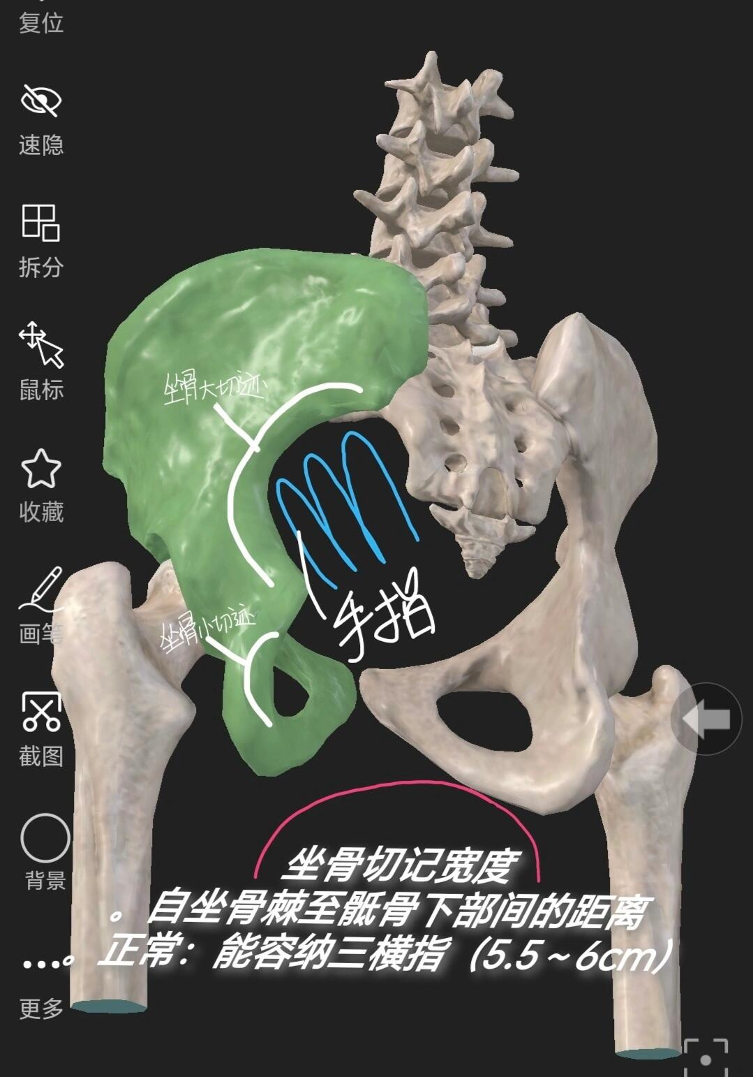 妇产科 骨盆测量