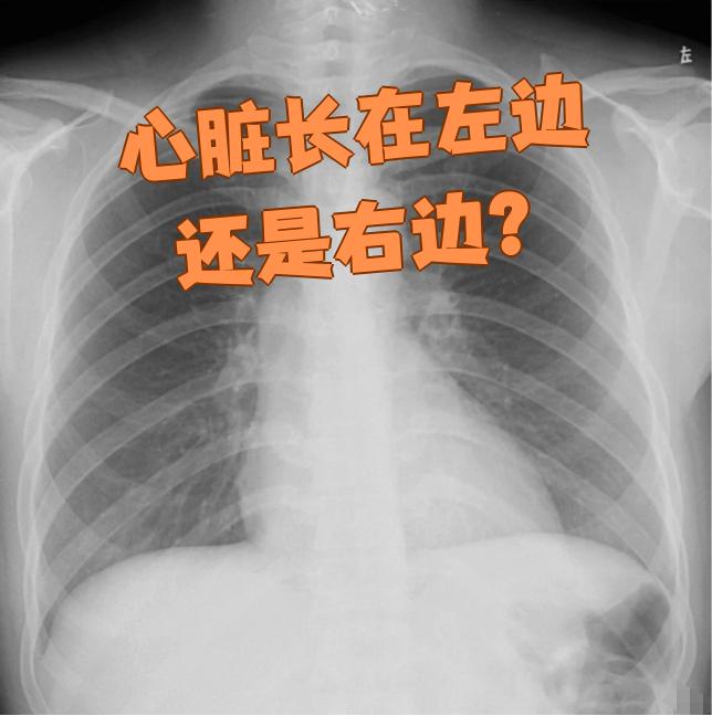 心脏通常长在左边,但也有极少数人心脏长在右边