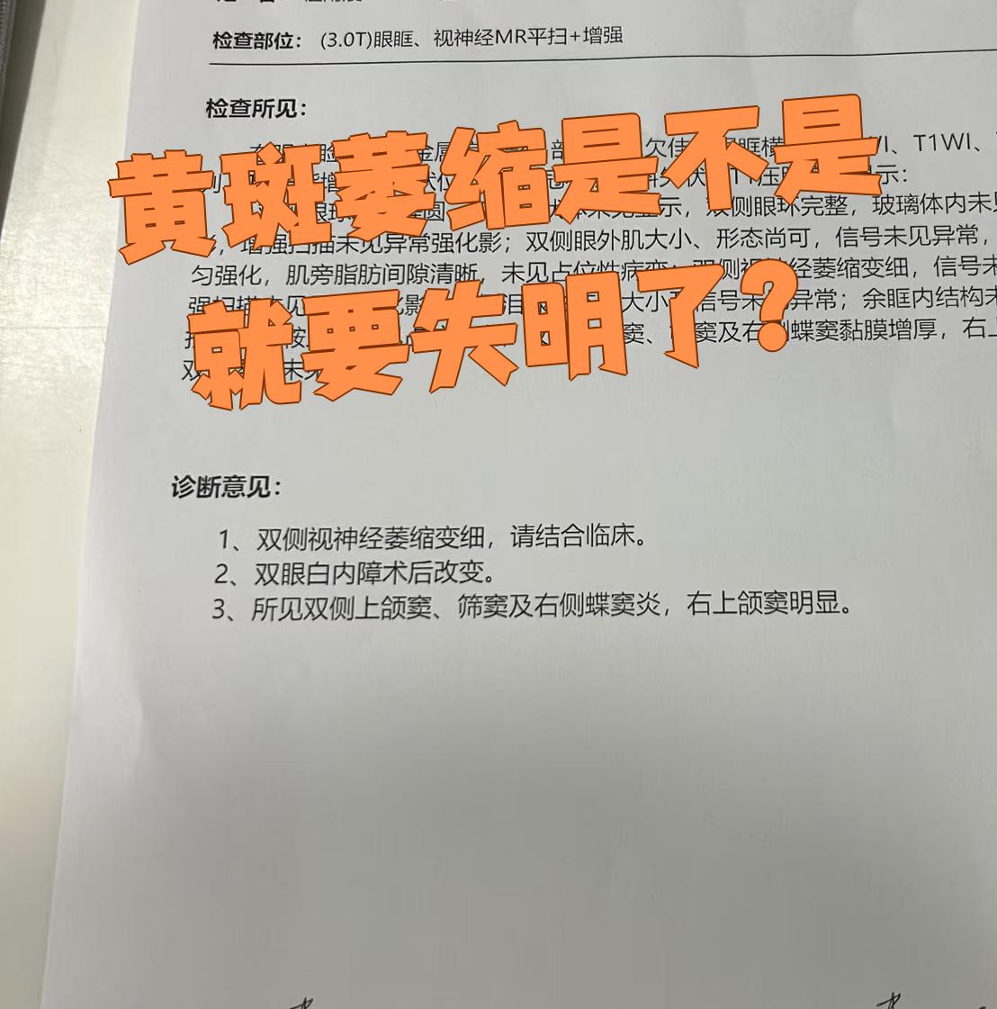 黄斑萎缩可能由多种原因引起如玻璃体变形视网膜血管疾病