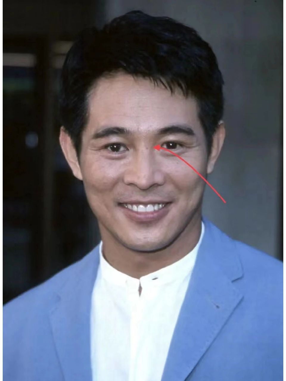 山根有痣鼻梁正面有痣 鼻梁正面有痣,40岁后 身体变差有小病痛.