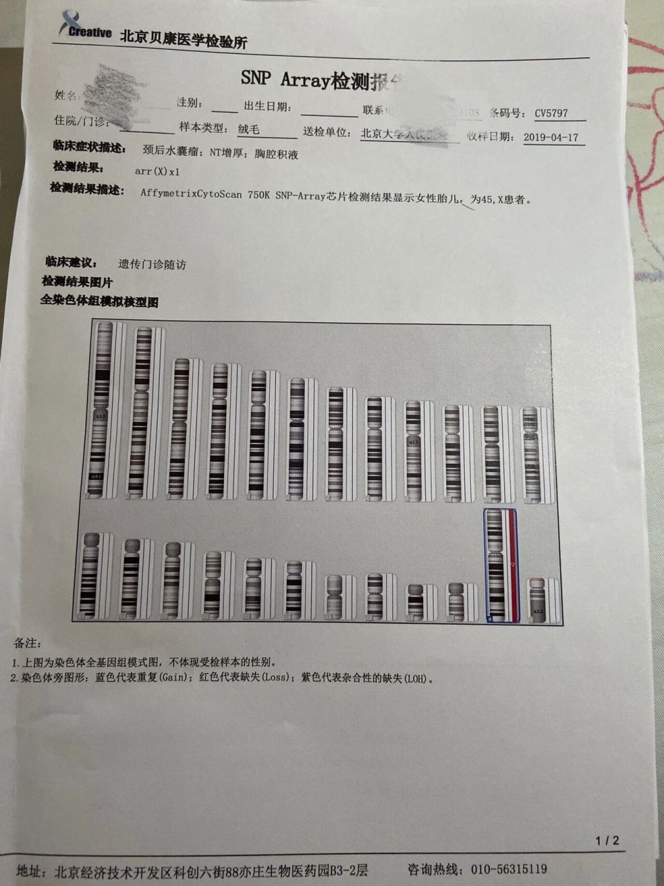 两次胎儿染色体异常,成功生娃经历 有了女儿后,每天都沉浸在幸福中