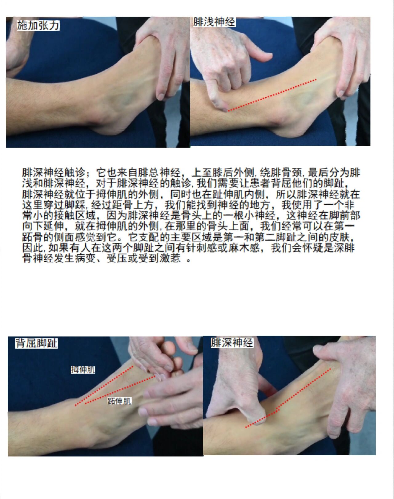 神经动作学之腓浅神经腓深神经触诊方式 神经动作学之腓浅神经腓深