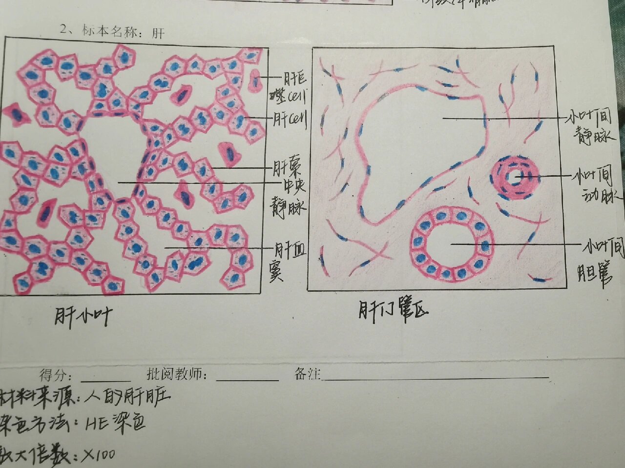 肝小叶手平面手绘图图片