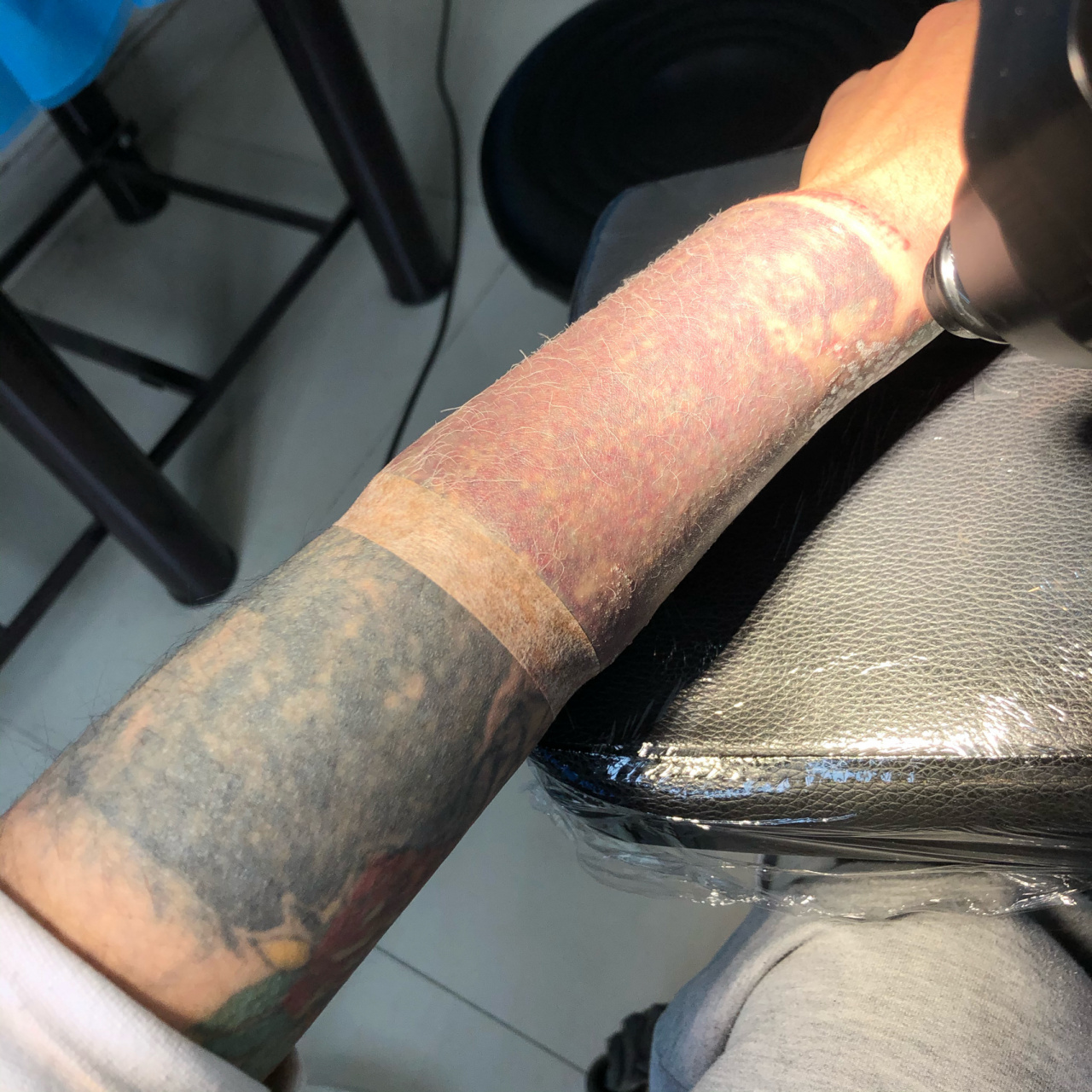 记录我的小臂黑臂洗纹身31566 我 现在 正坐在 工作室的沙发上