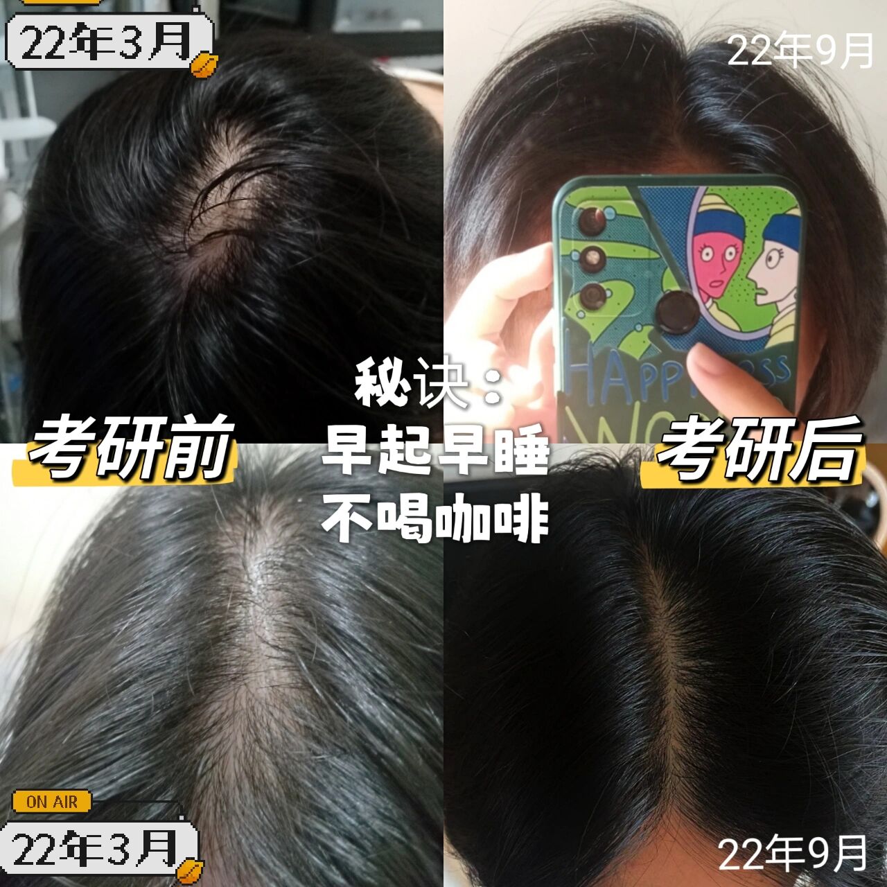 因考研秃头而焦虑的同学看过来(不是广) 首先,不要慌,一切都会好起来