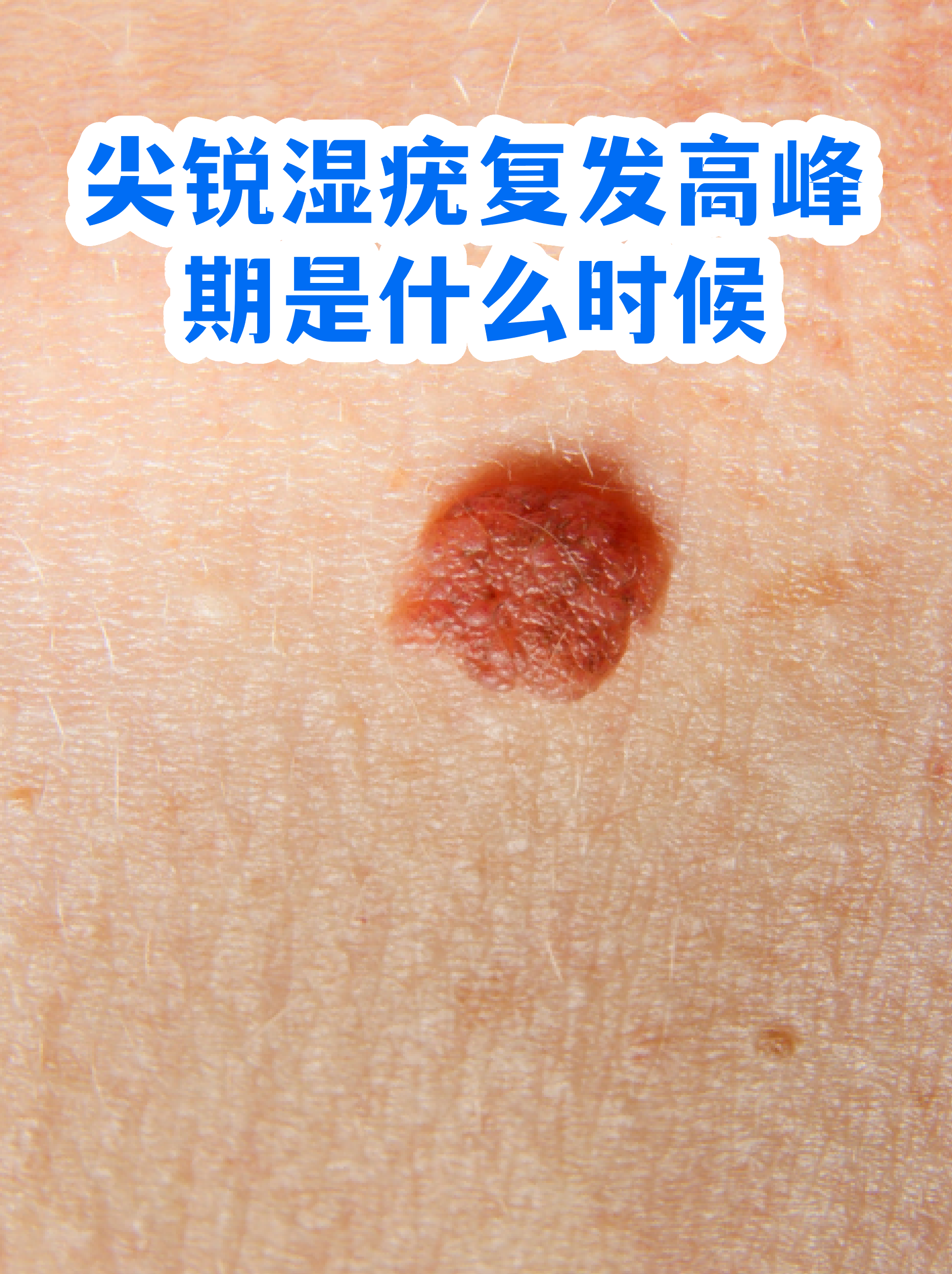  最近病毒高发期是哪个病毒一月几次了啊(2020现在什么病毒高发期)