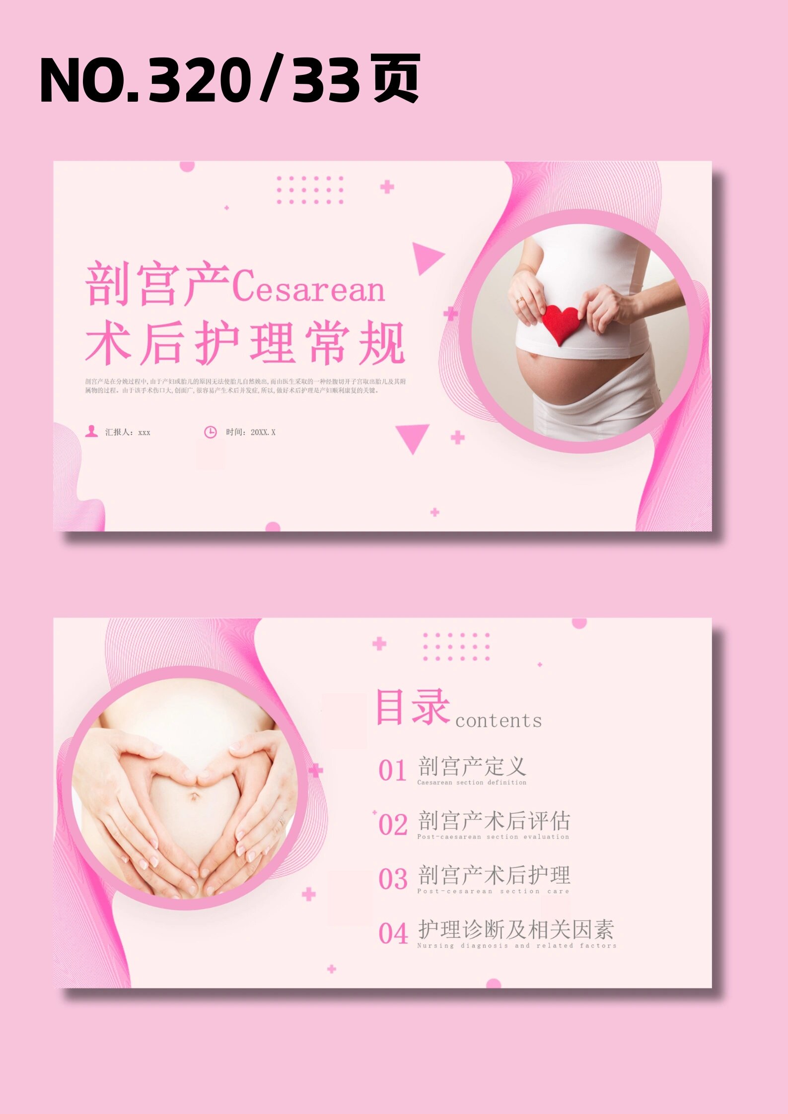 剖宫产术后护理常规ppt 🍀320 🍀33页 🍀图片和文字都可以编辑