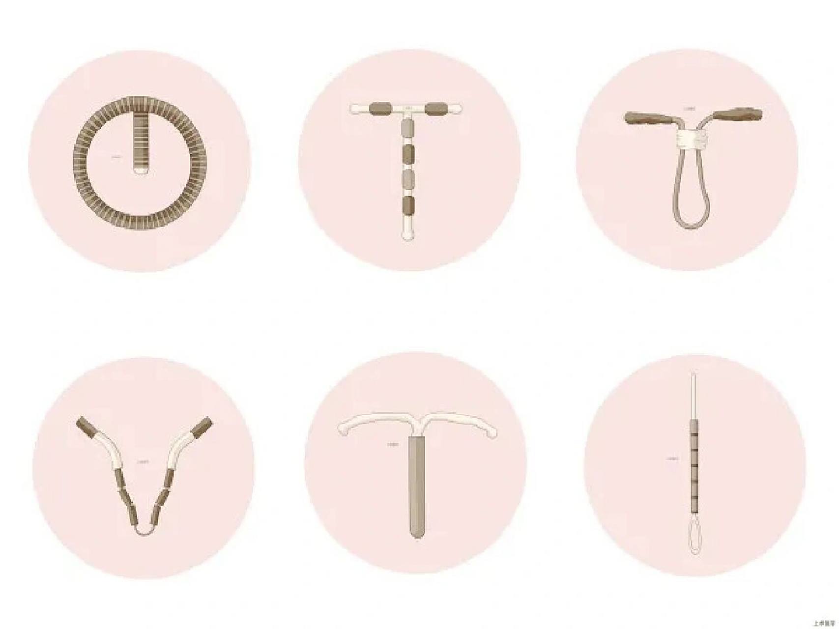 你准备好上节育环"4" 节育环有哪些类型?