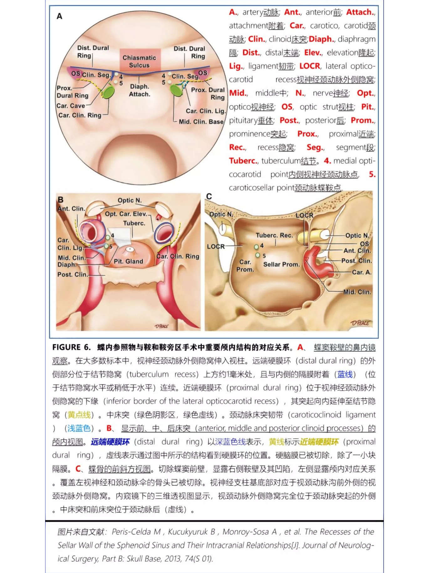 蝶窦解剖图图片