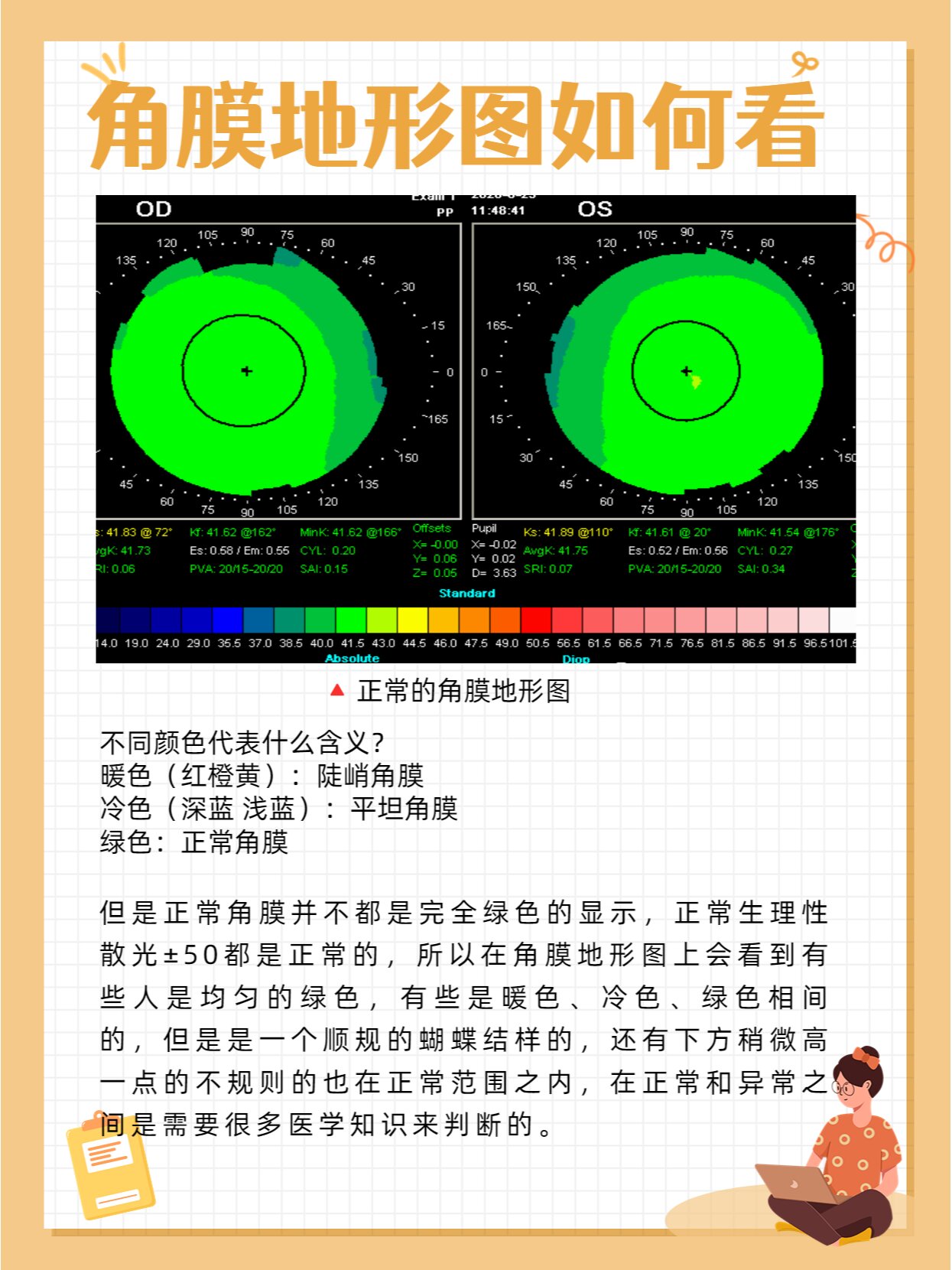 角膜地形图的作用图片