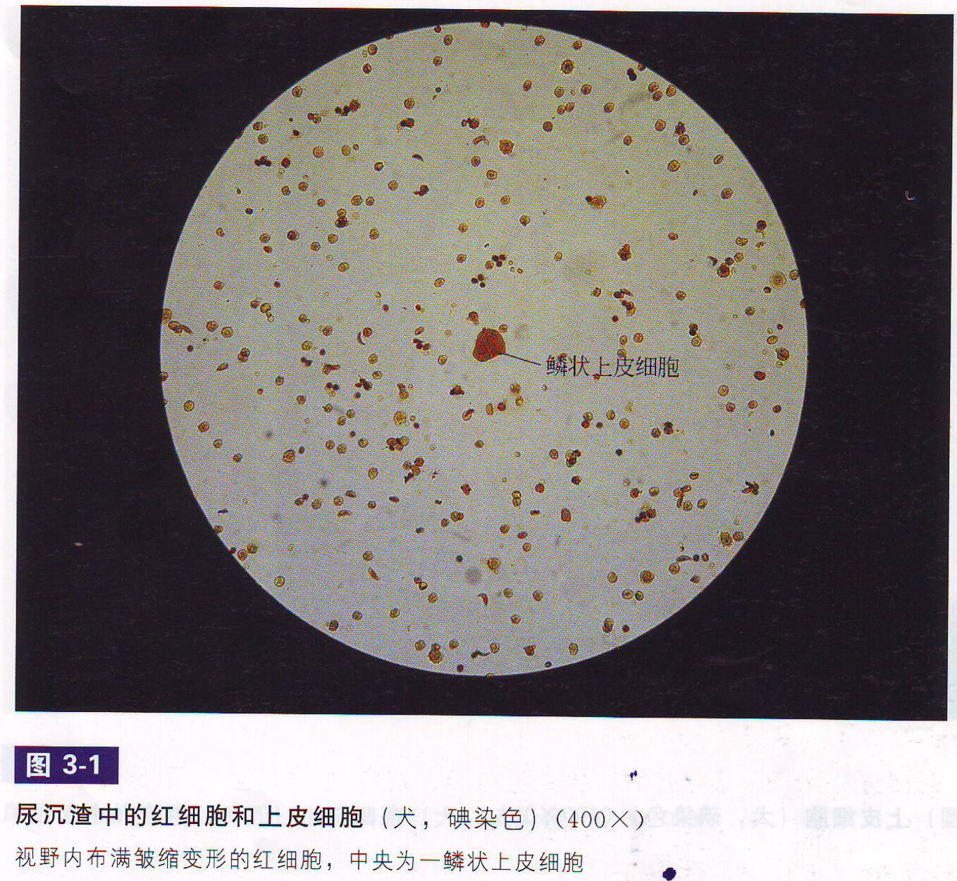 尿沉渣镜检图片