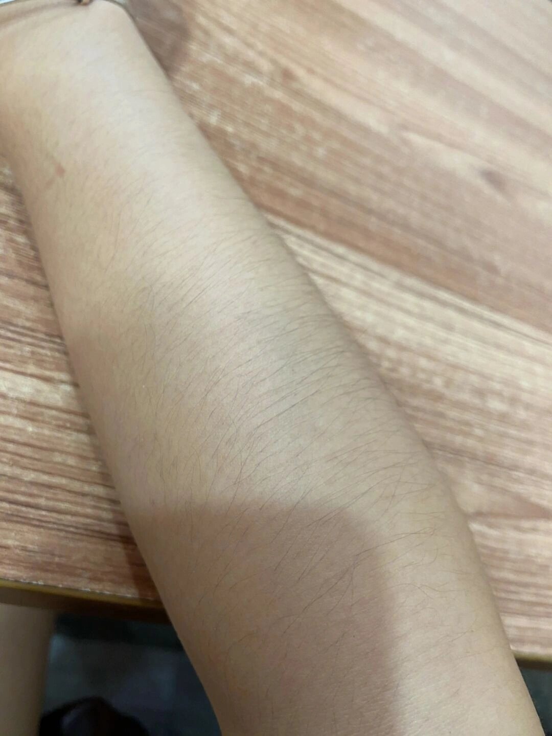 女生汗毛为什么那么重 女生胳膊汗毛旺盛可能是由于个体差异,激素水平