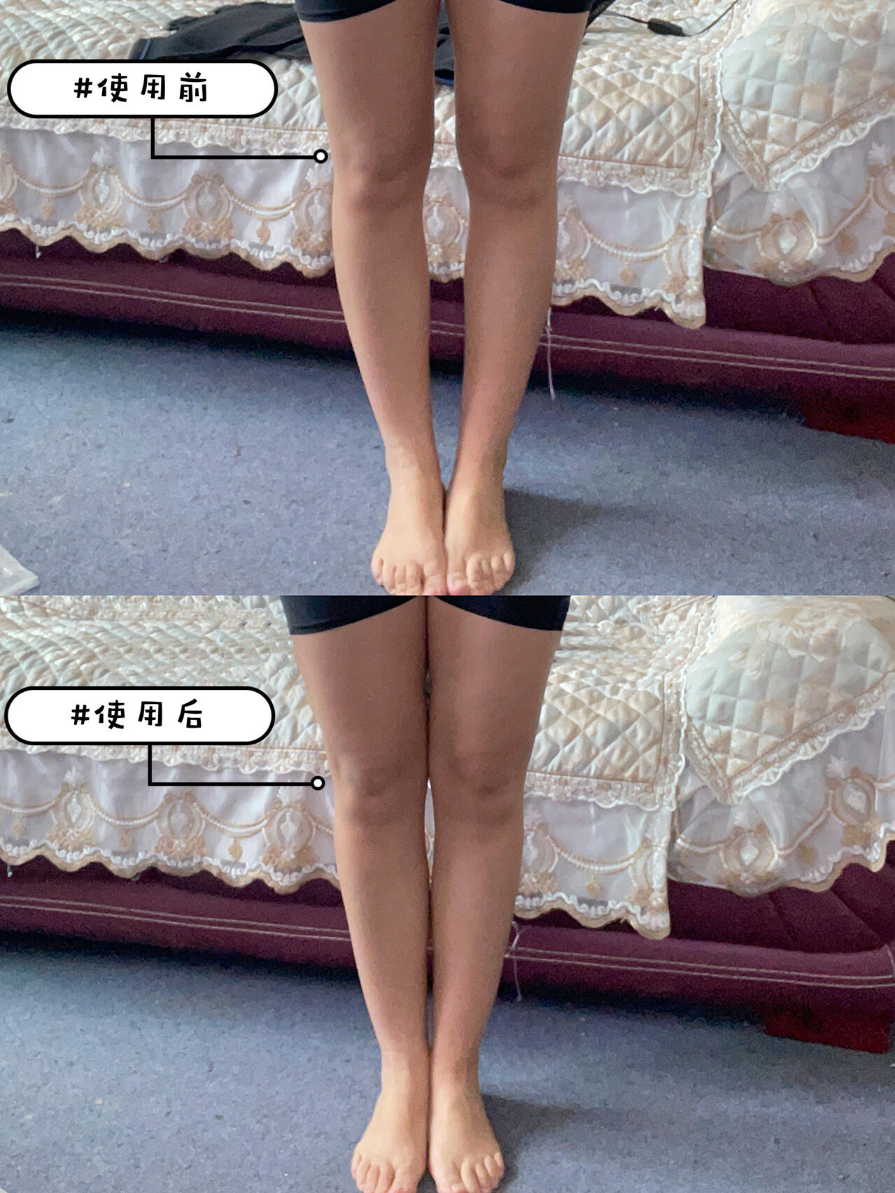 o型腿妹子有救了!赶紧用起来